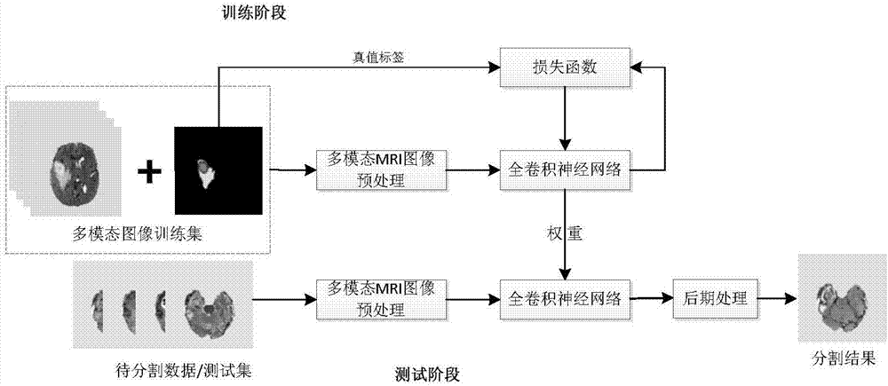 Automatic segmentation method for MRI image brain tumor based on full convolutional network