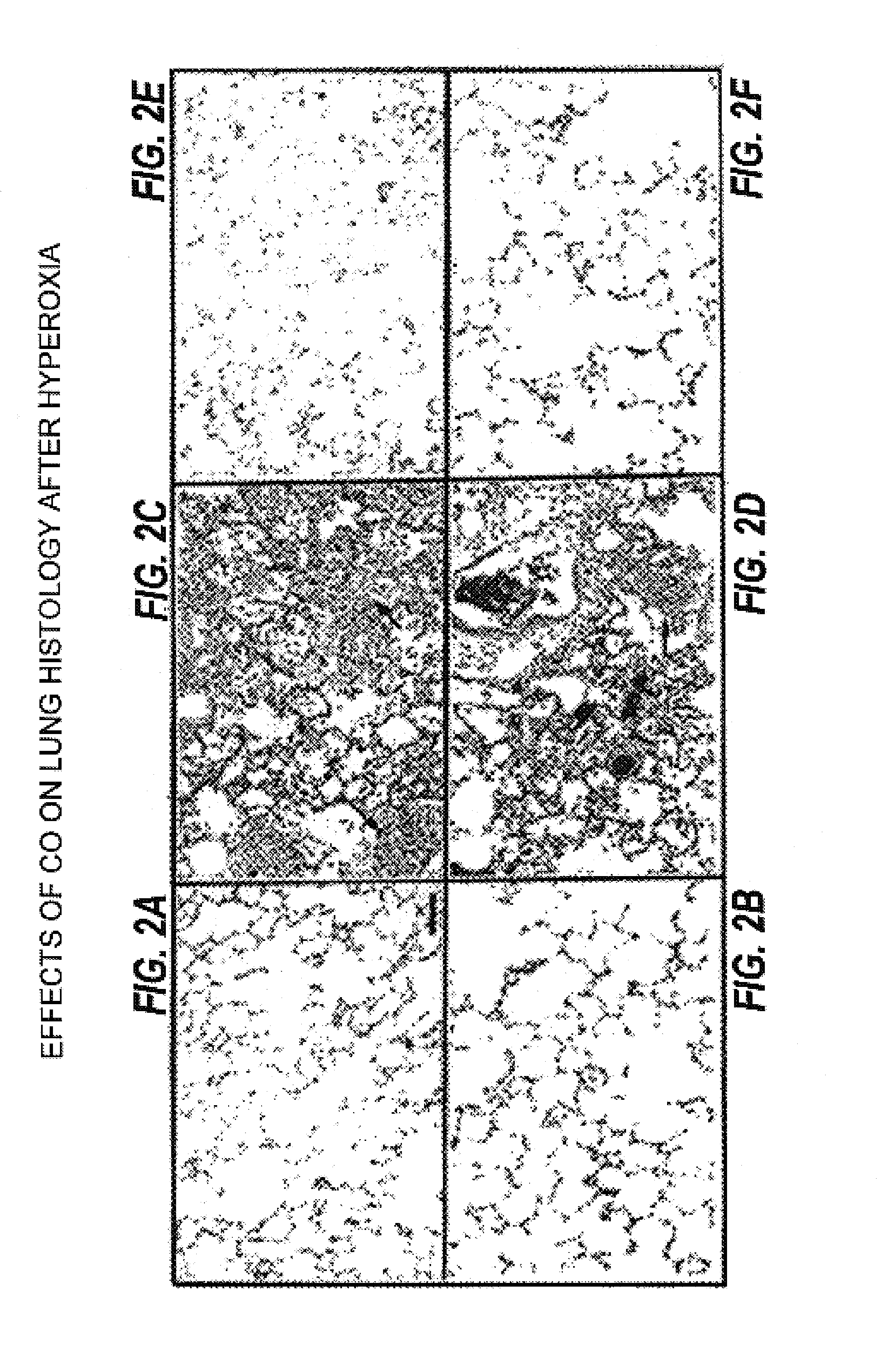 Carbon monoxide as a biomarker and therapeutic agent