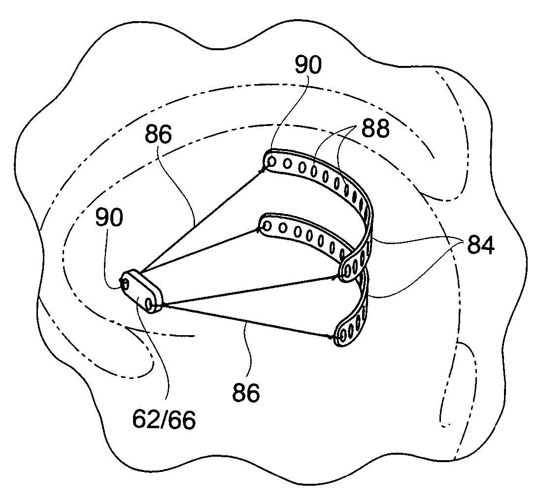 Magnetic force devices, systems, and methods for resisting tissue collapse within the pharyngeal conduit