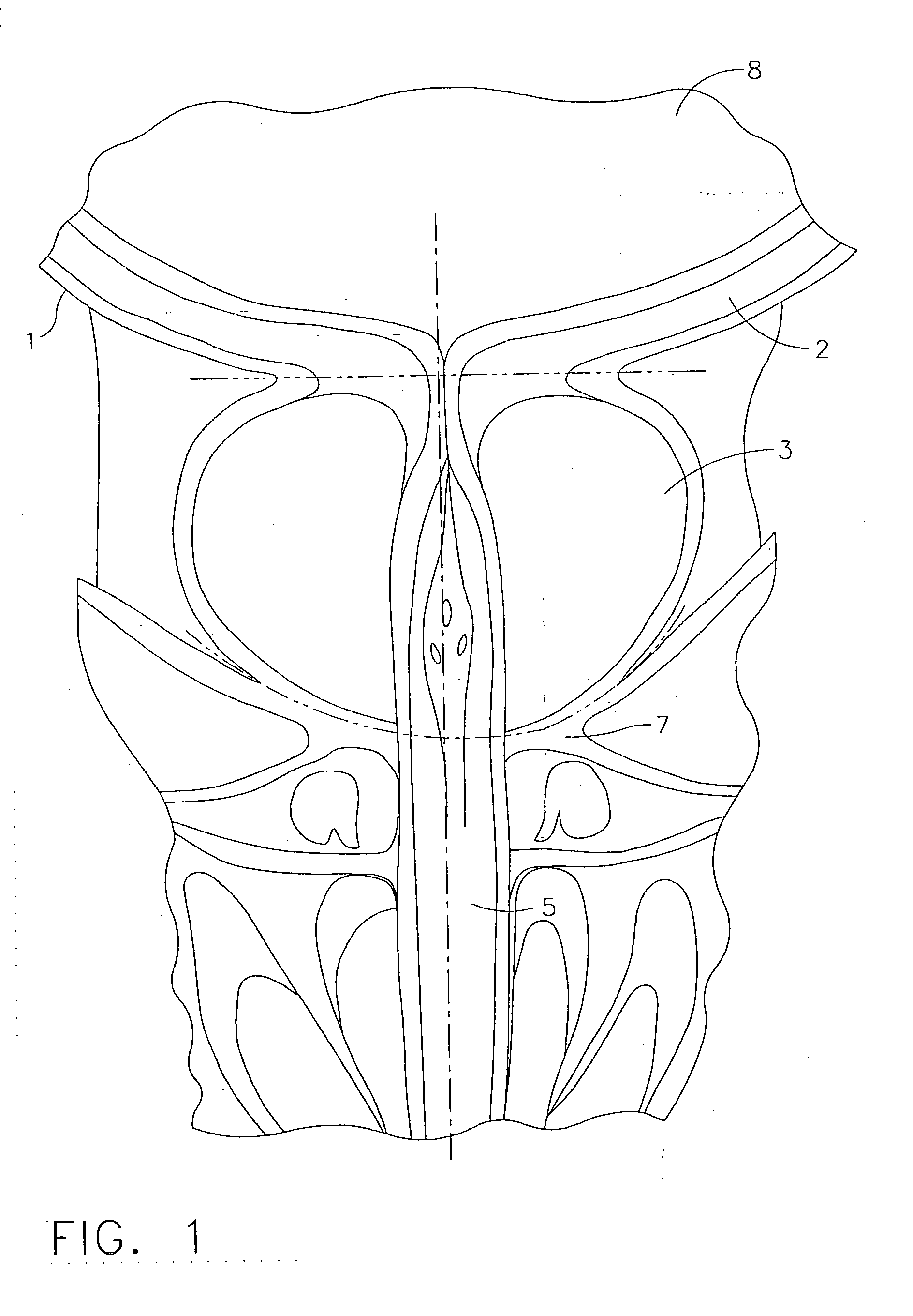 Method and instrument for effecting anastomosis of respective tissues defining two body lumens