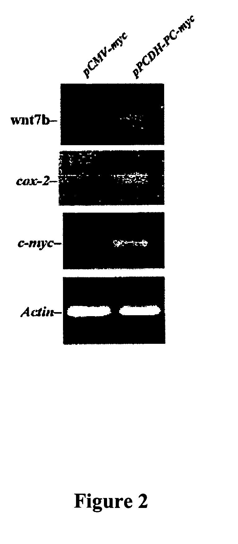 Methods to treat or prevent hormone-resistant prostate cancer using siRNA specific for protocadherin-PC, or other inhibitors of protocadherin-PC expression or activity