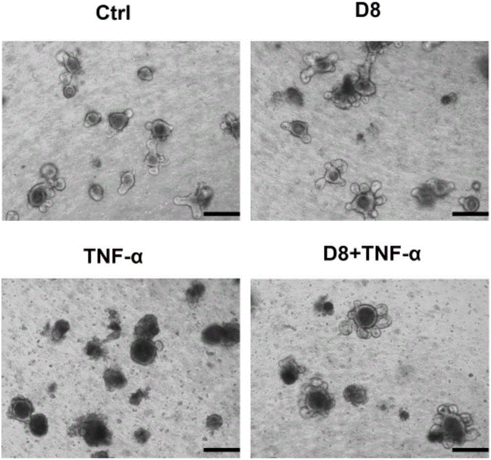 Lactobacillus D8 and application thereof