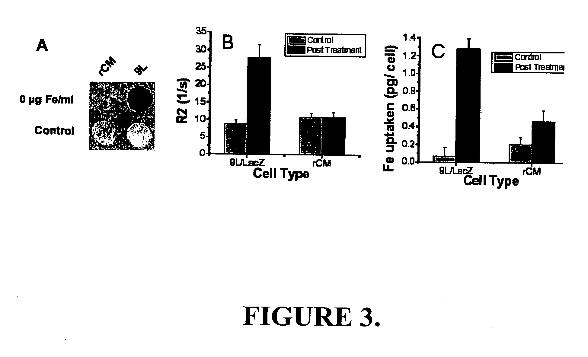 Chlorotoxin-labeled nanoparticle compositions and methods for targeting primary brain tumors