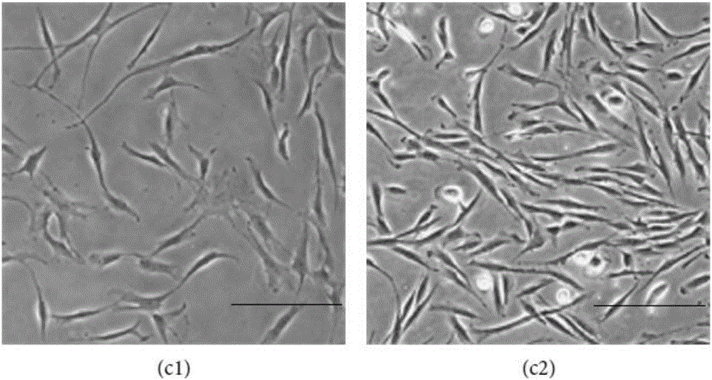 Cytomedicine for preventing intrauterine adhesion and repairing endometrium injury, and preparation method thereof