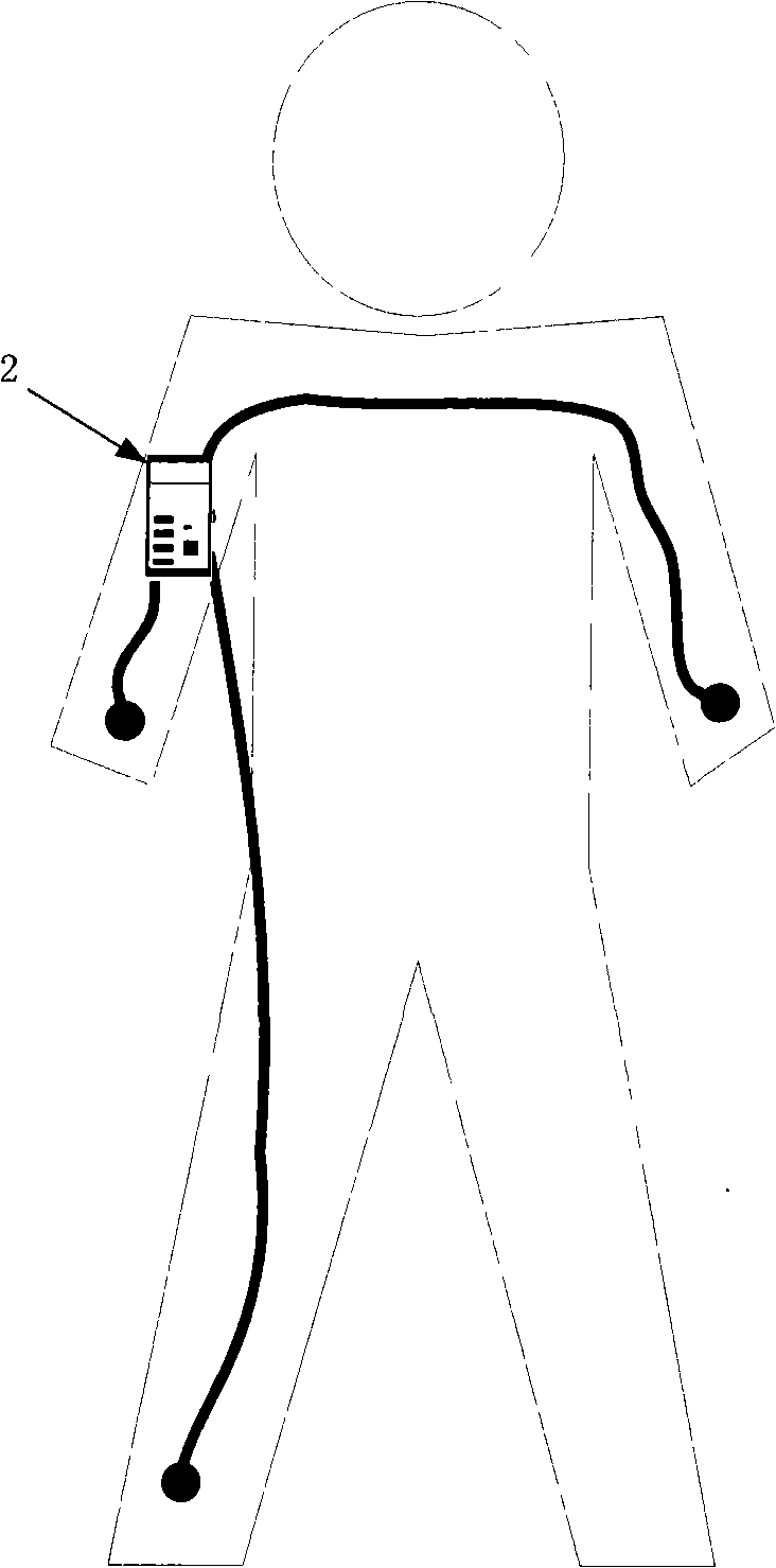 Standard three-lead electrocardiogram monitor system based on wireless sensor network