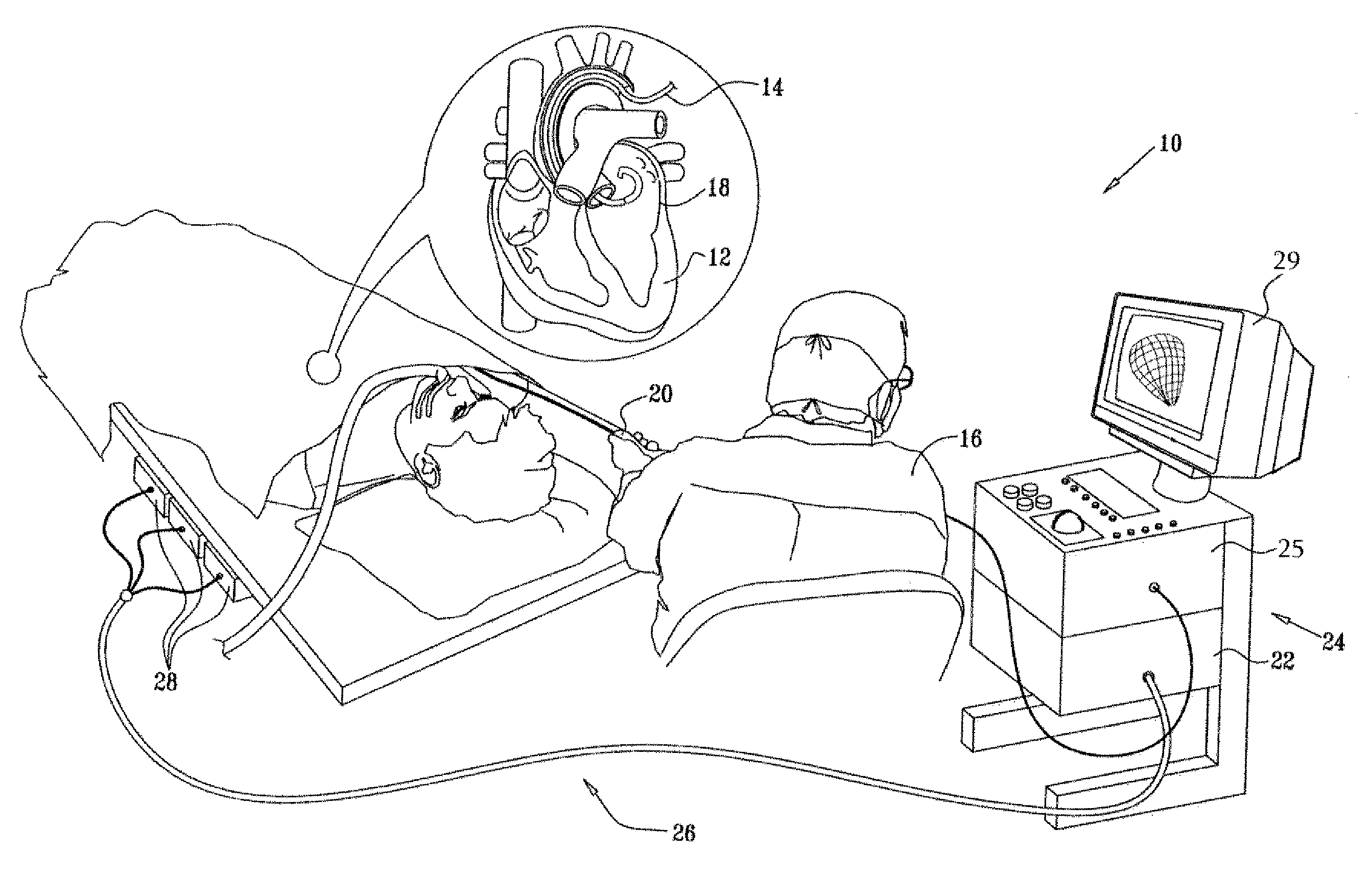 Dual-purpose lasso catheter with irrigation using circumferentially arranged ring bump electrodes