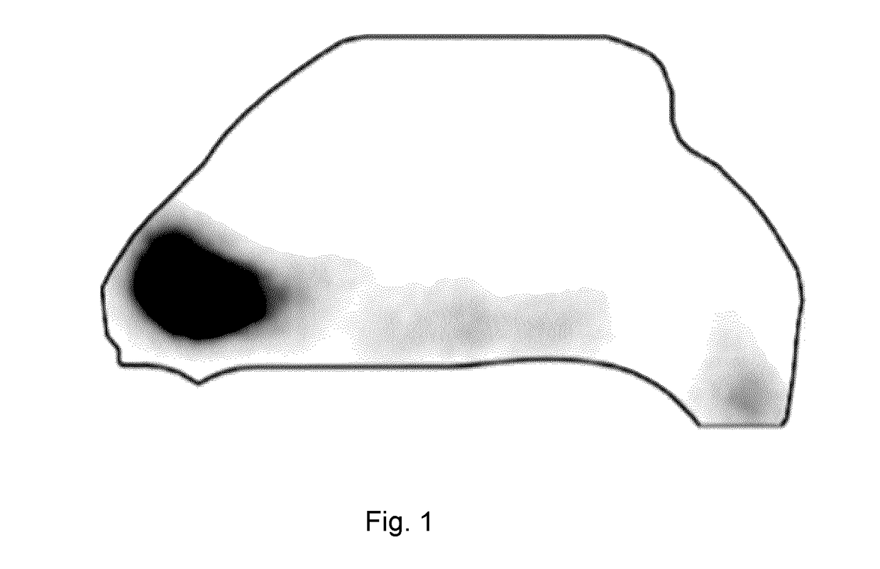 Triggered quantal drug delivery device, method and system ("tqd3")