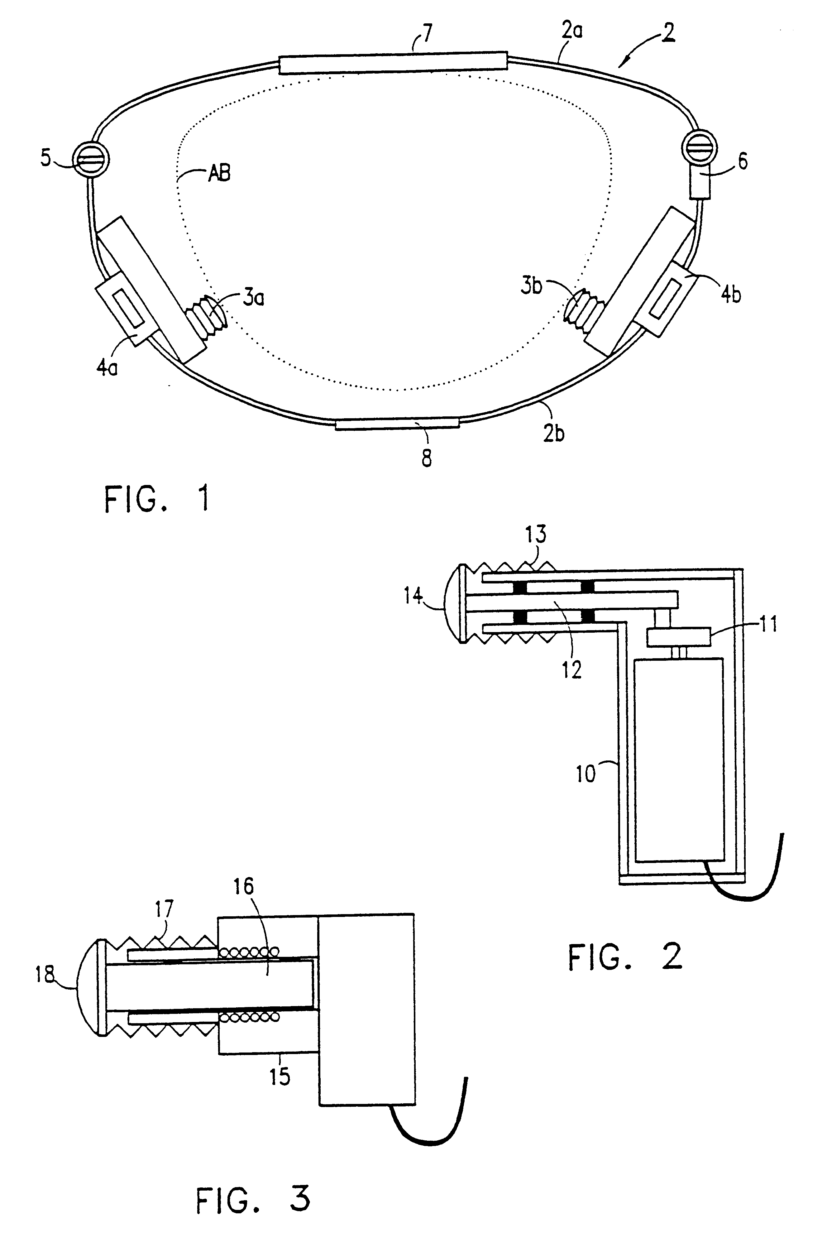 Vibrator appliance particularly useful for dialysis