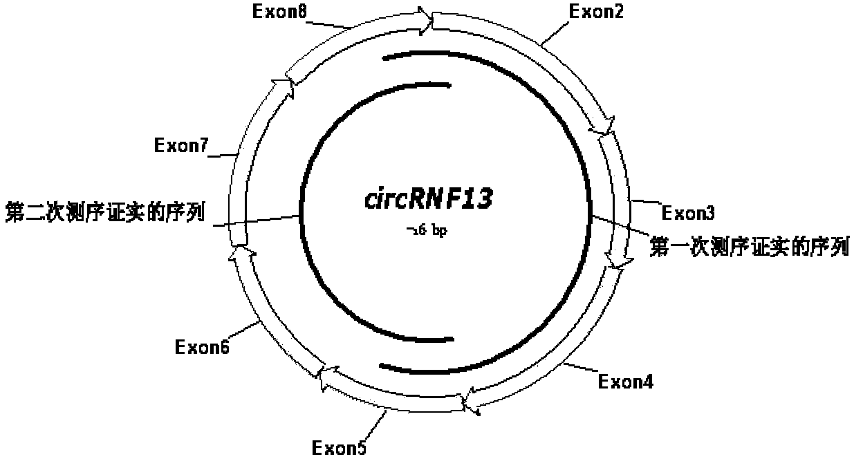 Application of reagent capable of promoting circular RNA (Ribonucleic Acid) circRNF13 expression to preparation of medicine for treating tongue squamous cell carcinoma