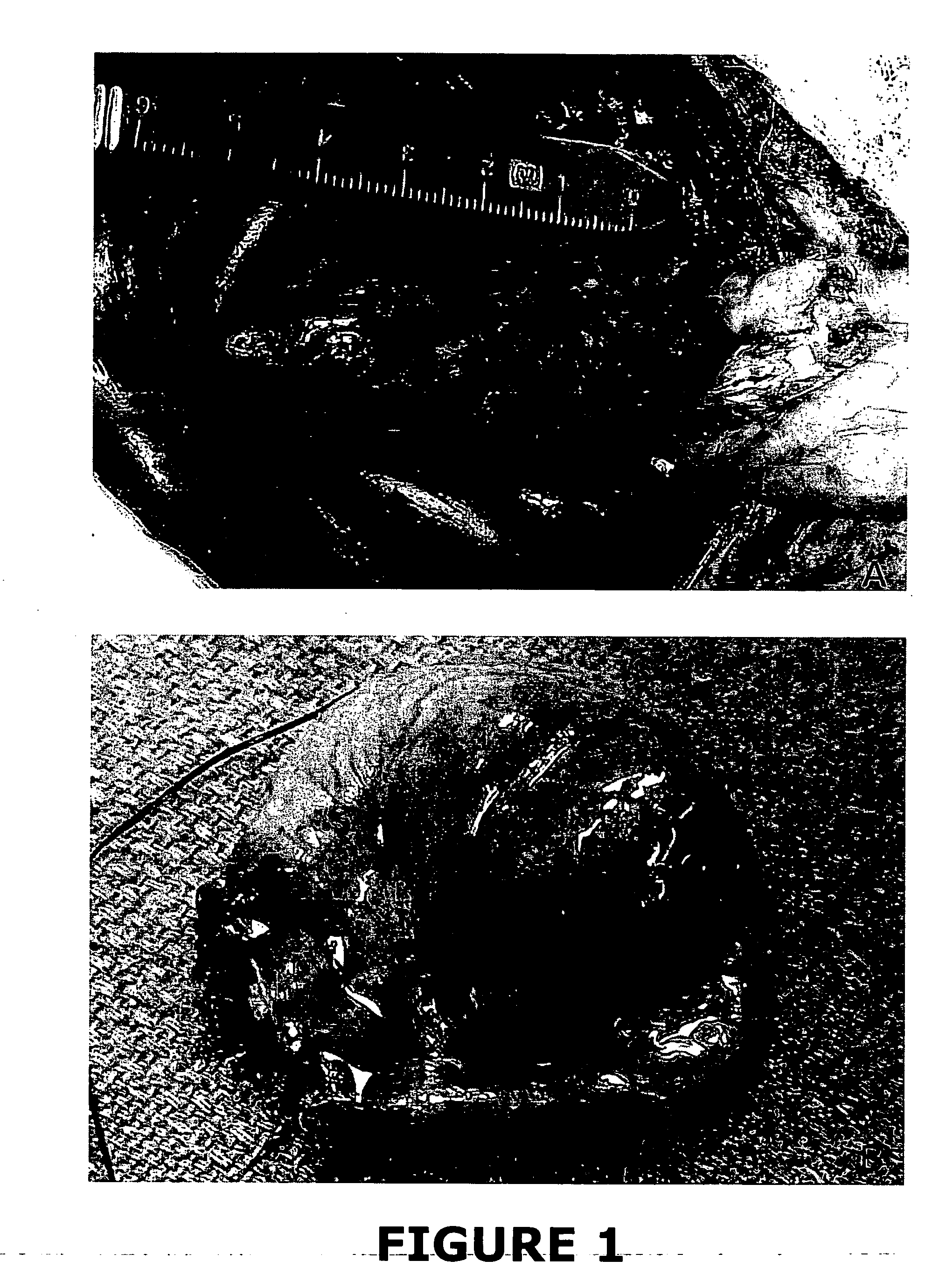 Urinary tract tissue graft compositions and methods for producing same