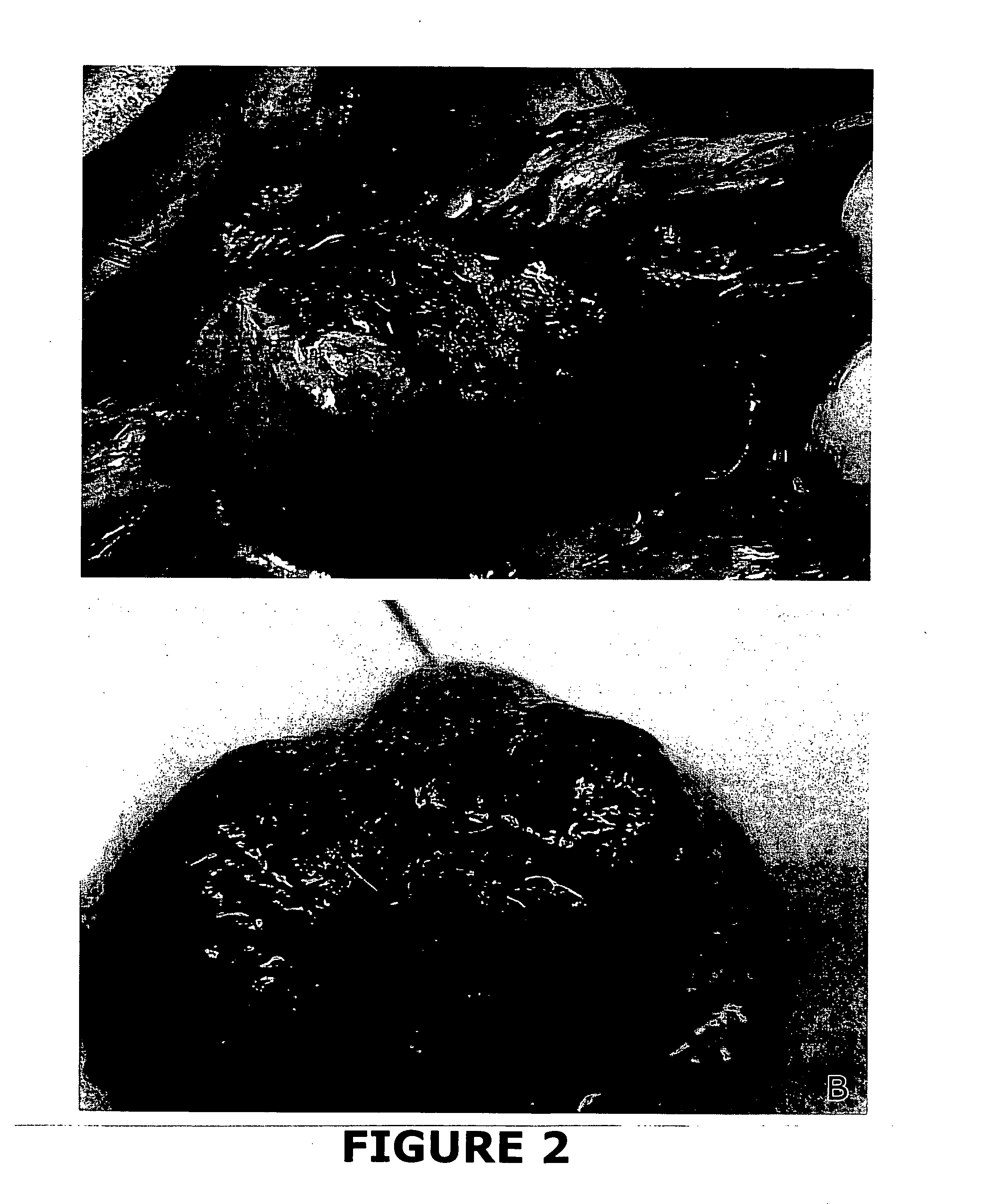 Urinary tract tissue graft compositions and methods for producing same