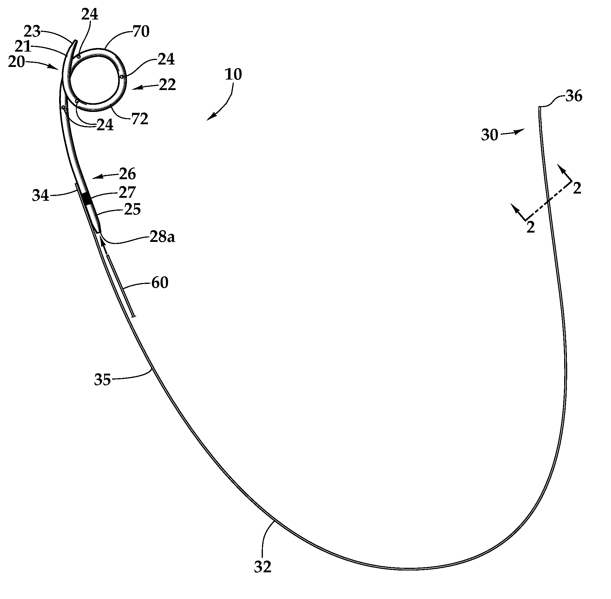 Ureteral stent