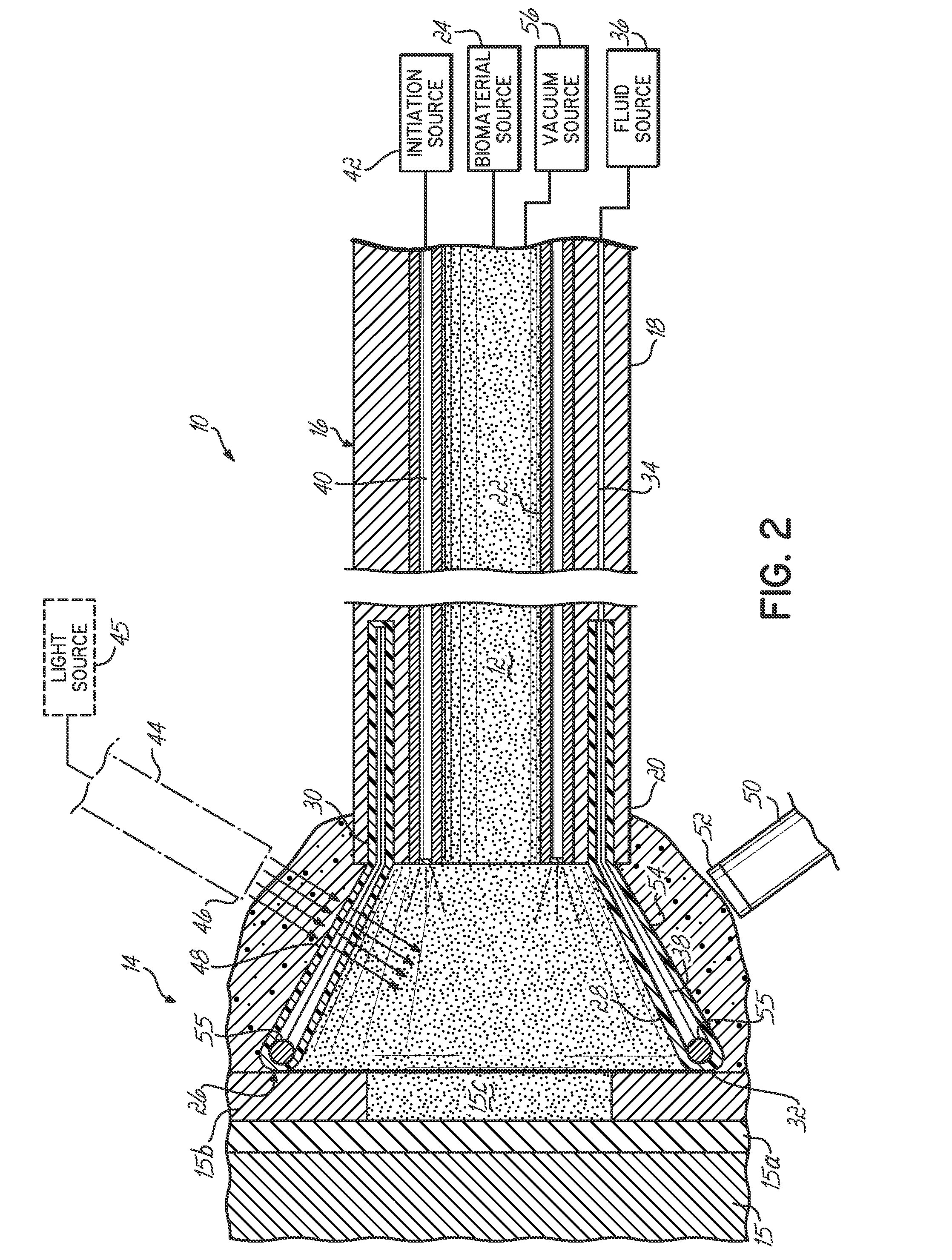 Apparatus for delivering a biocompatible material to a surgical site and method of using same