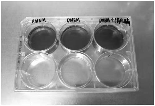 Preparation method of human liver cancer tissue and liver tissue active single cell suspension