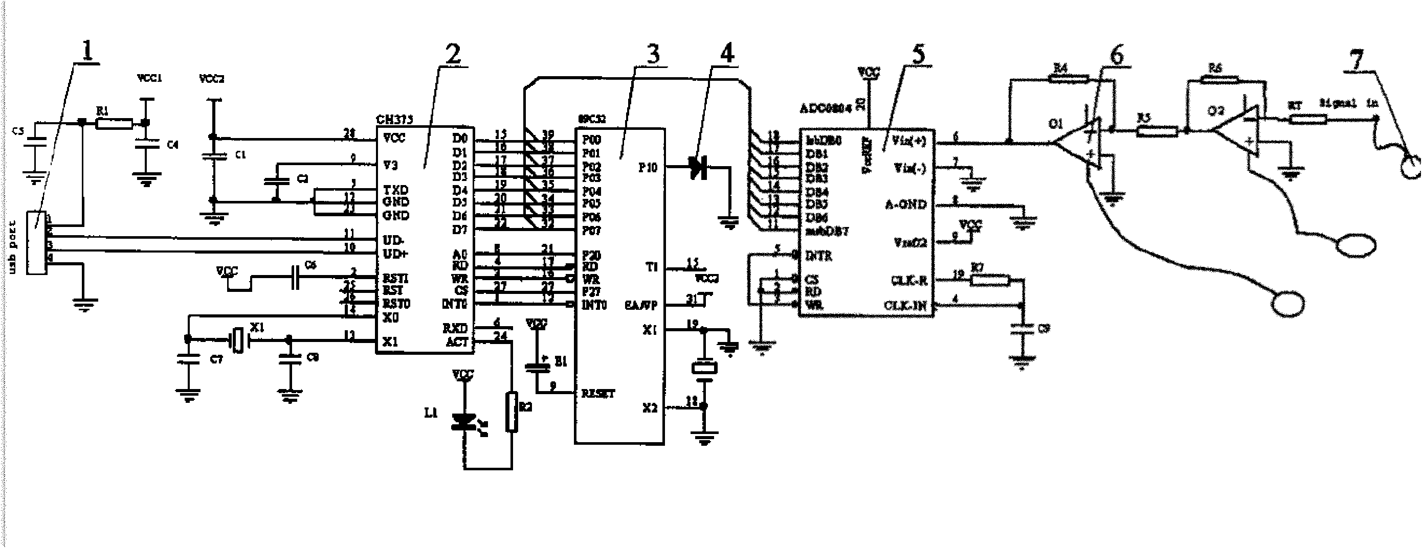 Peristalsis monitor