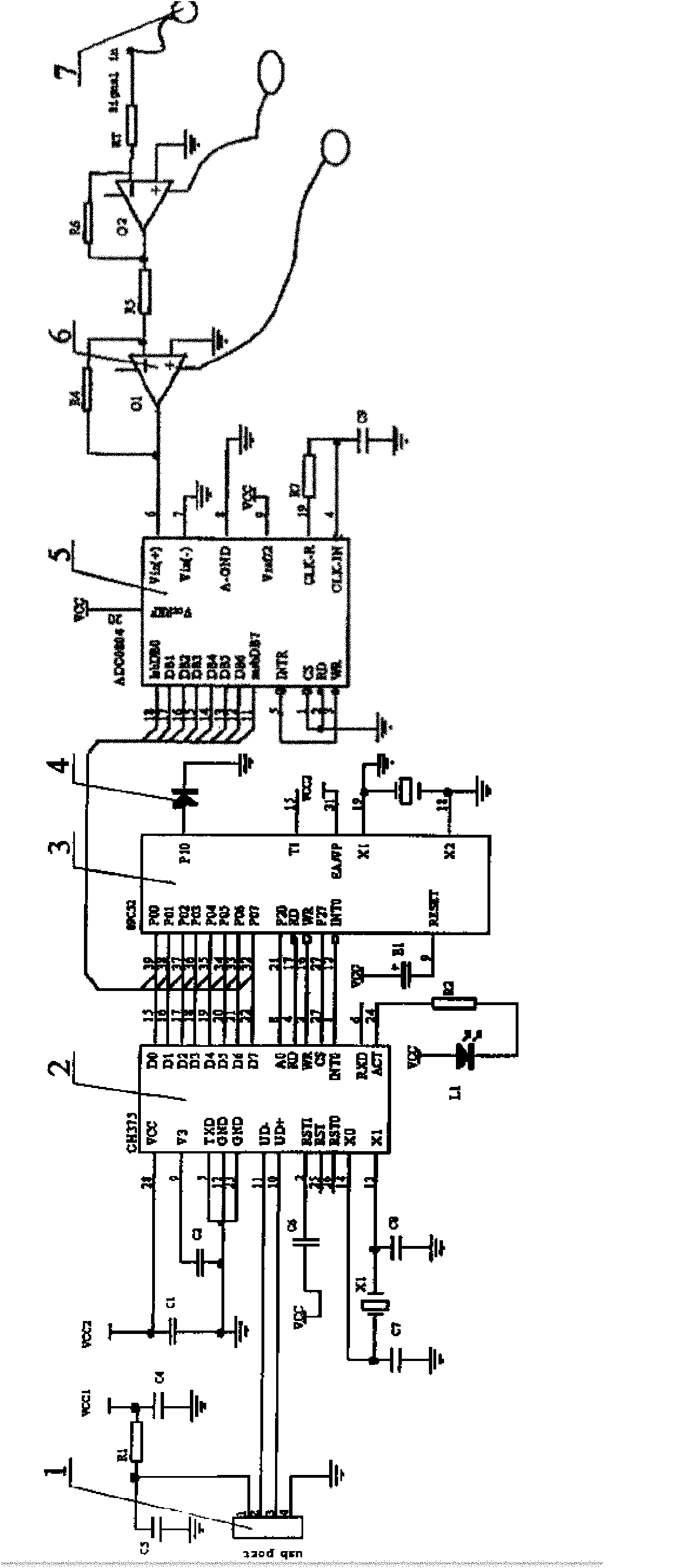 Peristalsis monitor