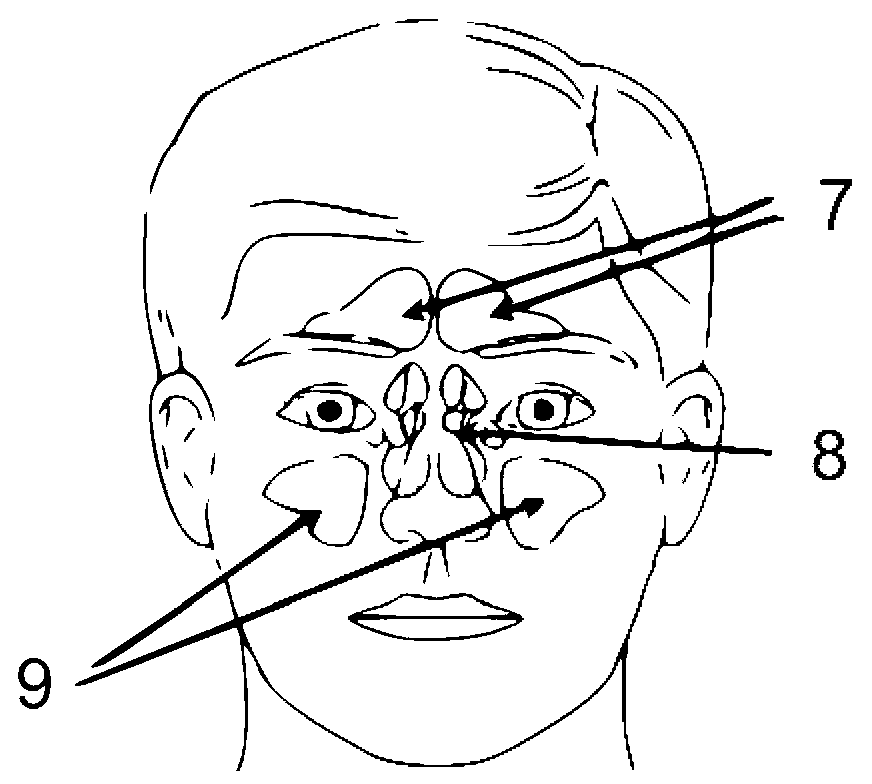 Medicine spraying device for treating nasosinusitis or allergic rhinitis