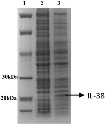 Medicine composition containing interleukin-38 recombinant protein and application of medicine composition