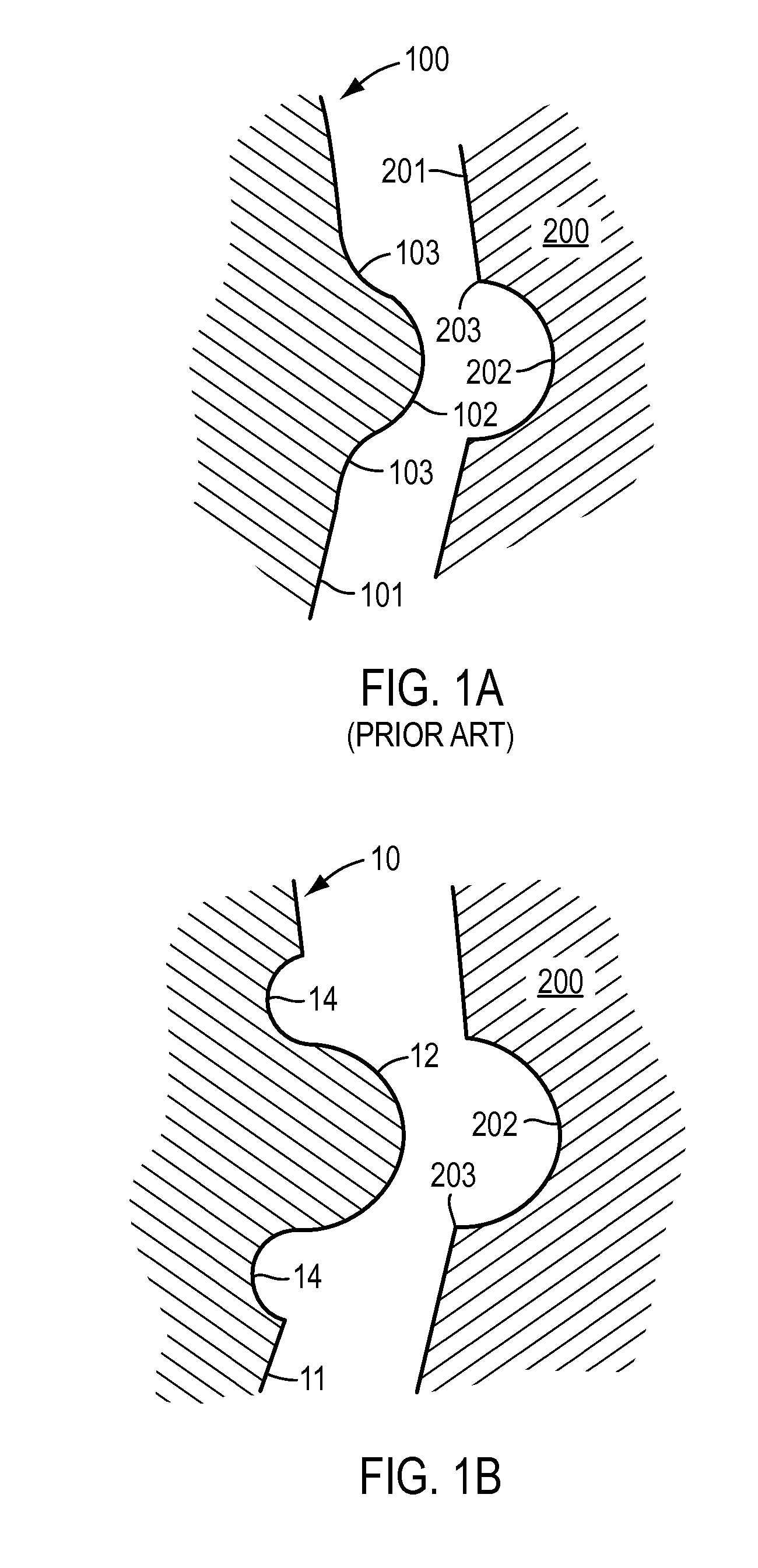 Abutment inlay