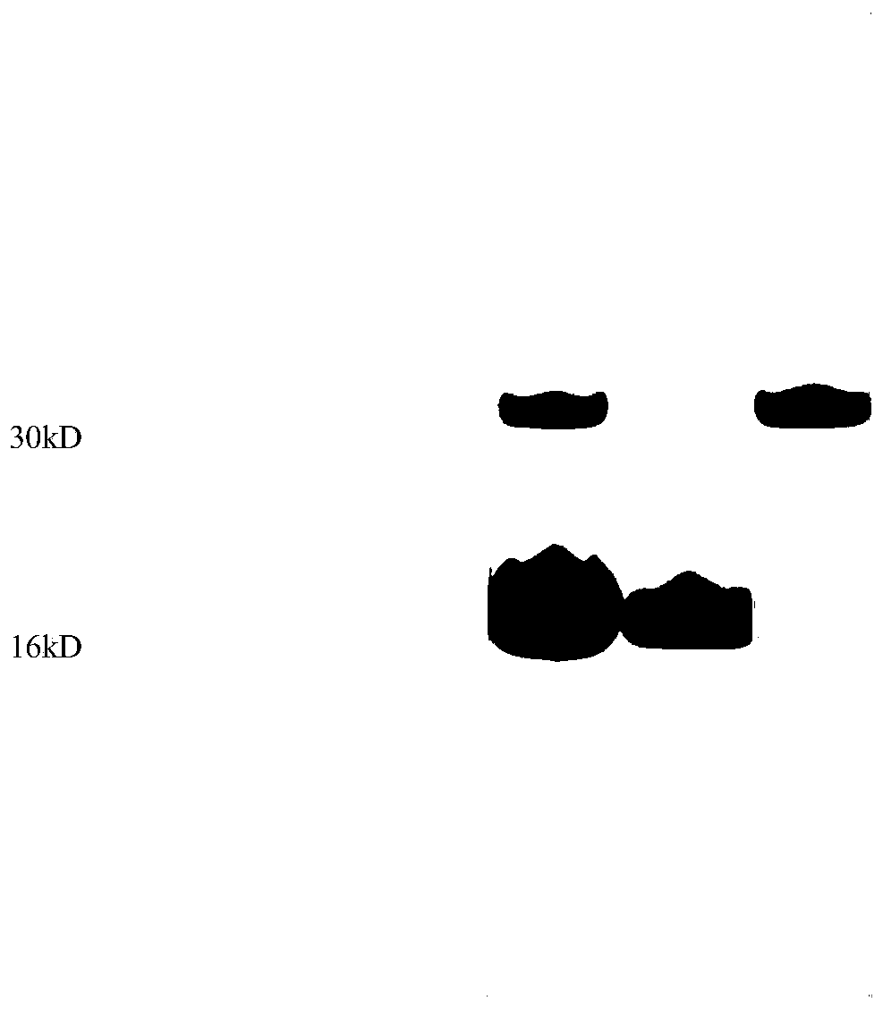 Method for preparing hemoglobin free of carbonic anhydrase