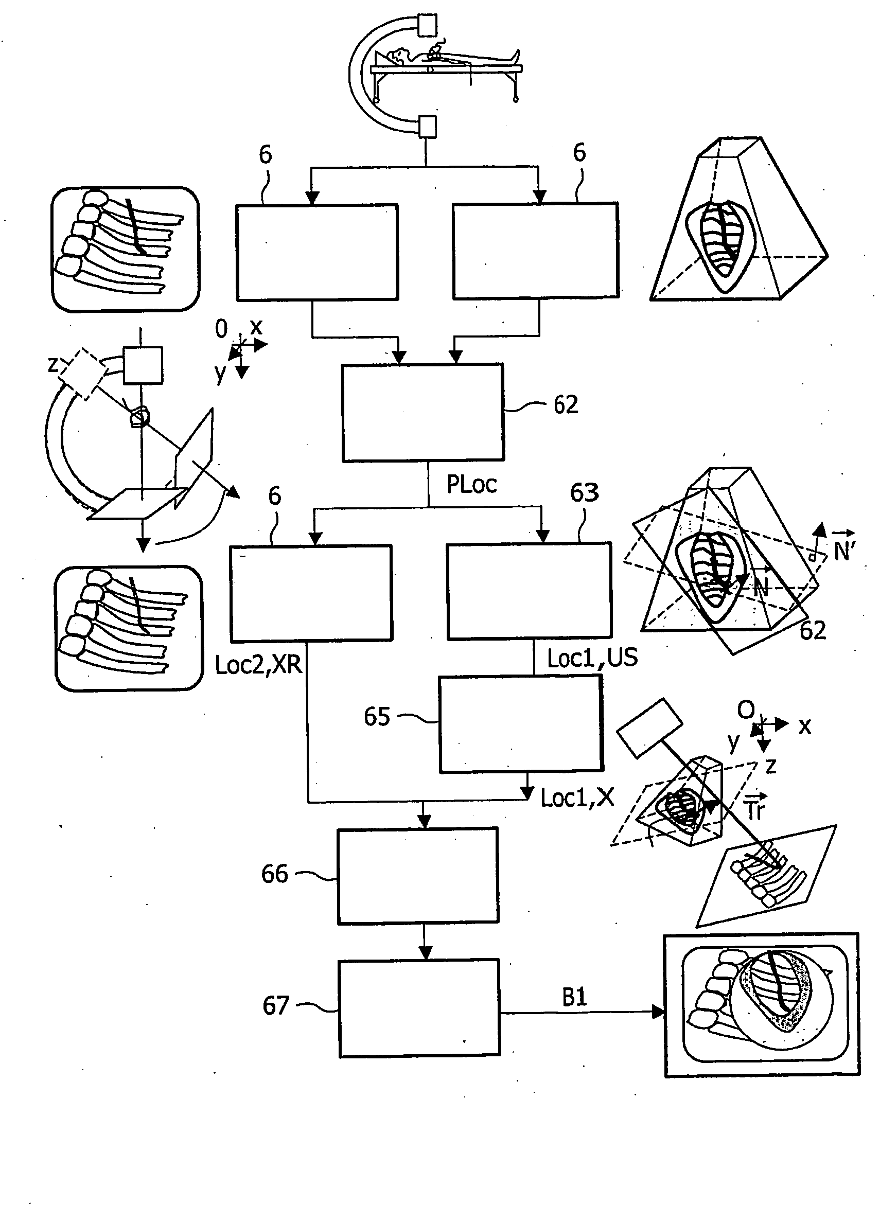 System For Guiding a Medical Instrument in a Patient Body