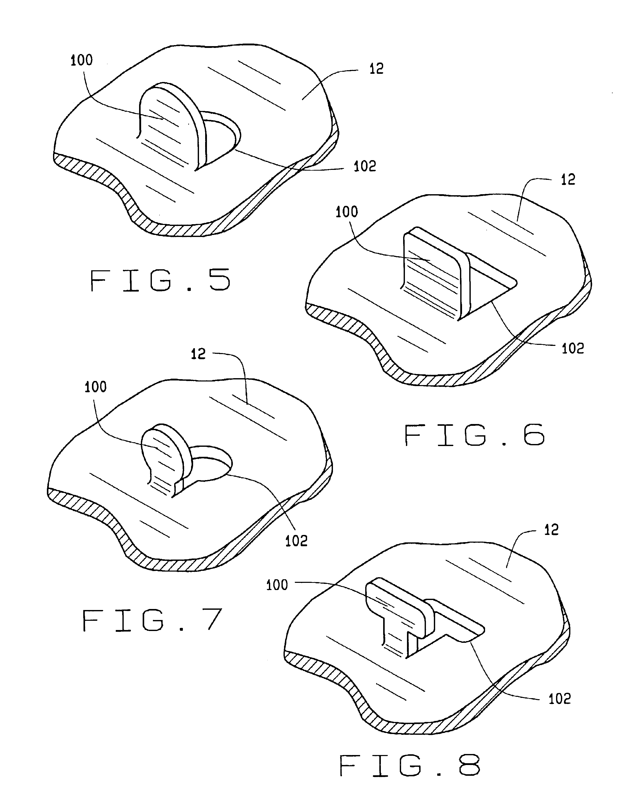 High friction brake shoe assembly