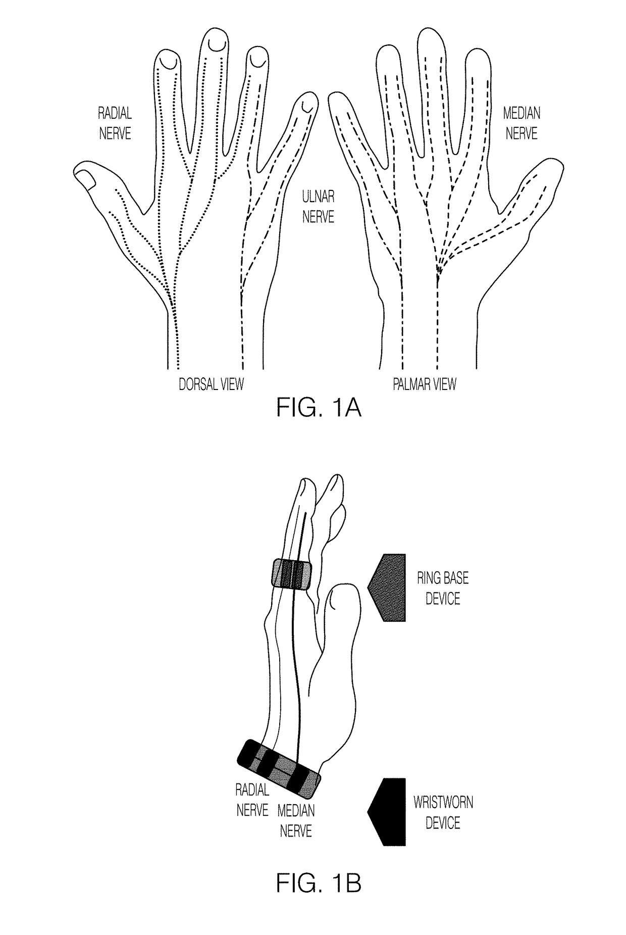 Systems and methods for peripheral nerve stimulation in the finger or hand to treat hand tremors