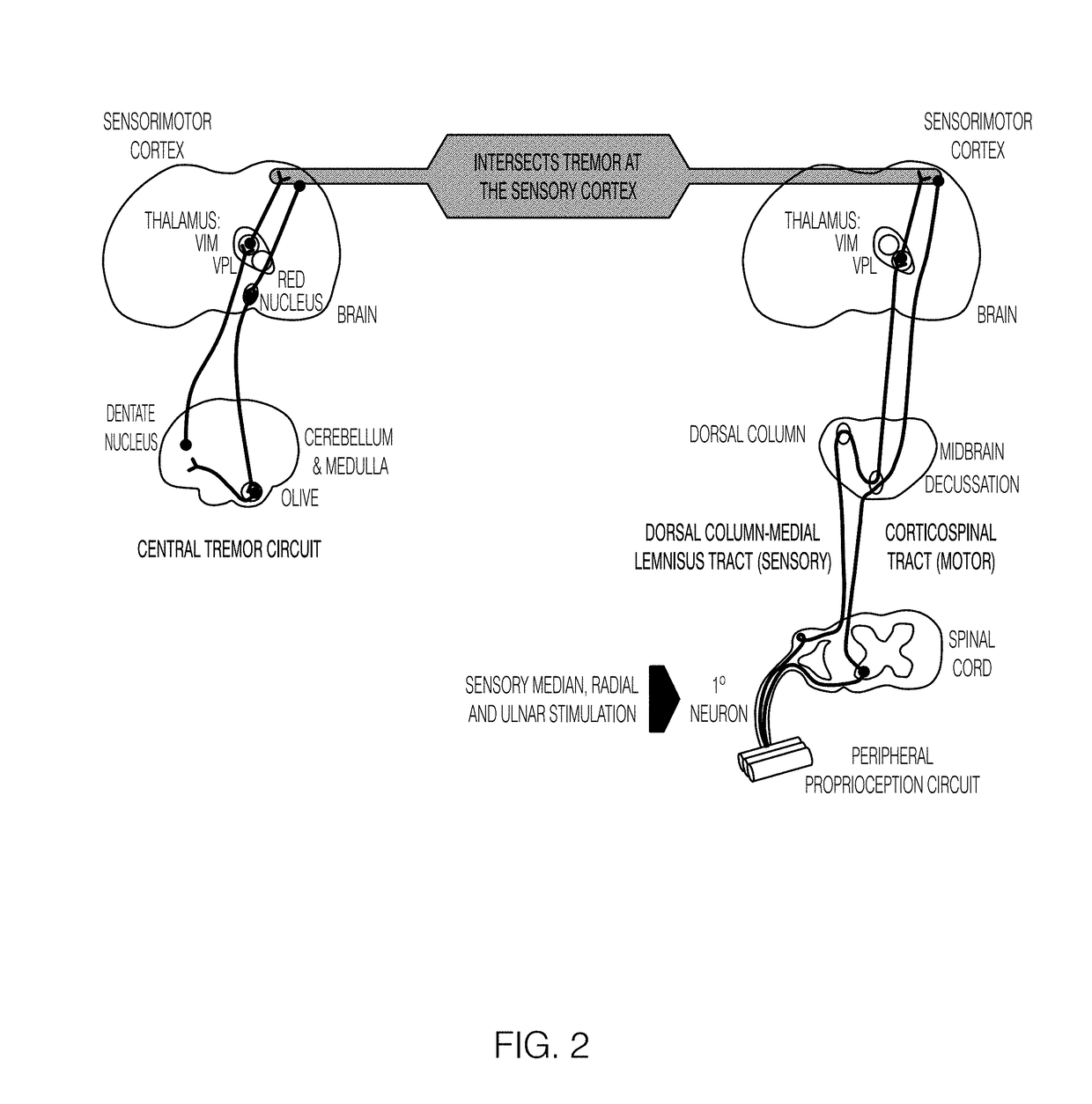 Systems and methods for peripheral nerve stimulation in the finger or hand to treat hand tremors