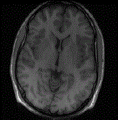 Self consistency based parallel magnetic resonance imaging quick reconstructing method