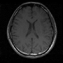 Self consistency based parallel magnetic resonance imaging quick reconstructing method