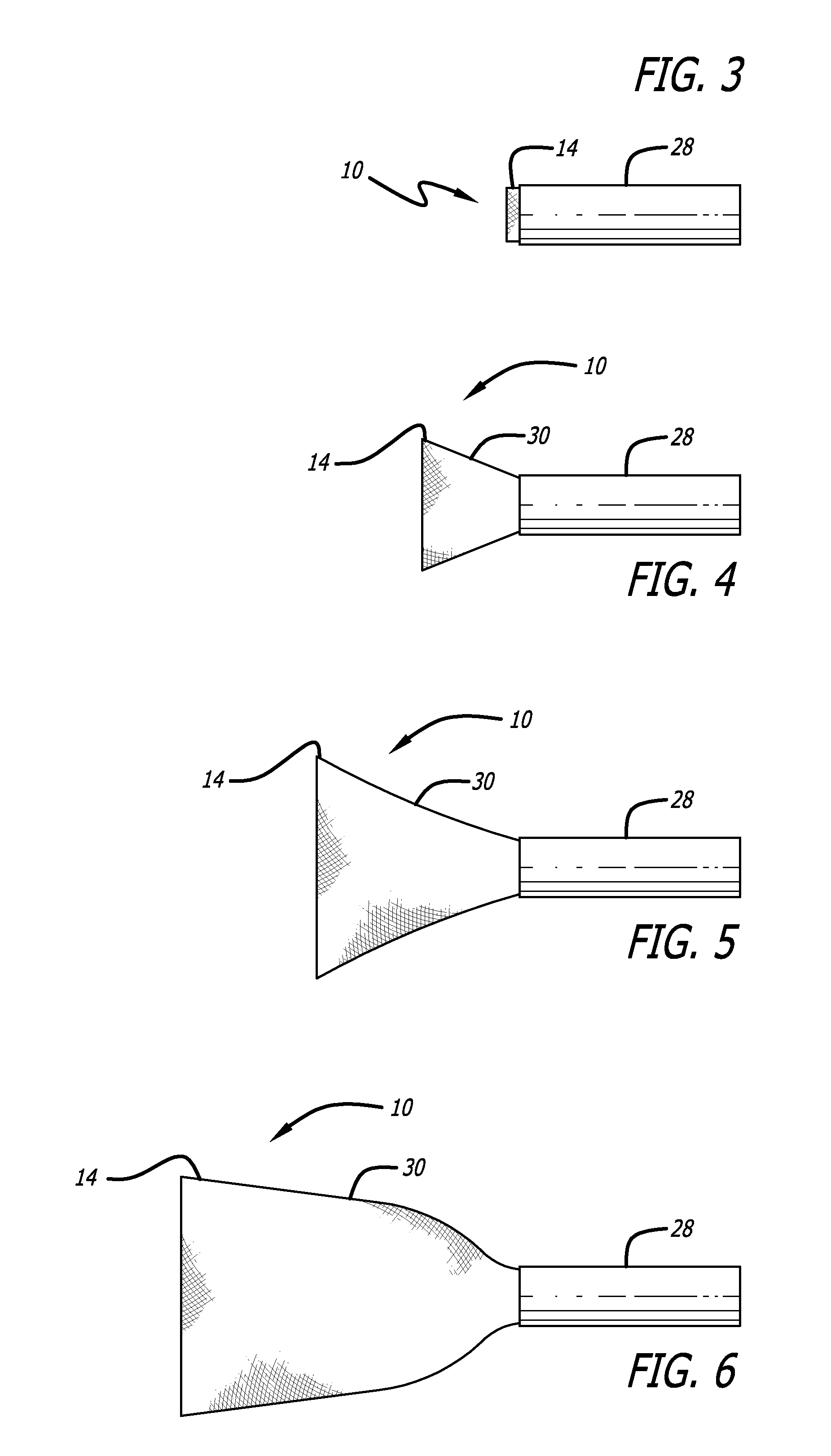 Stentless Support Structure