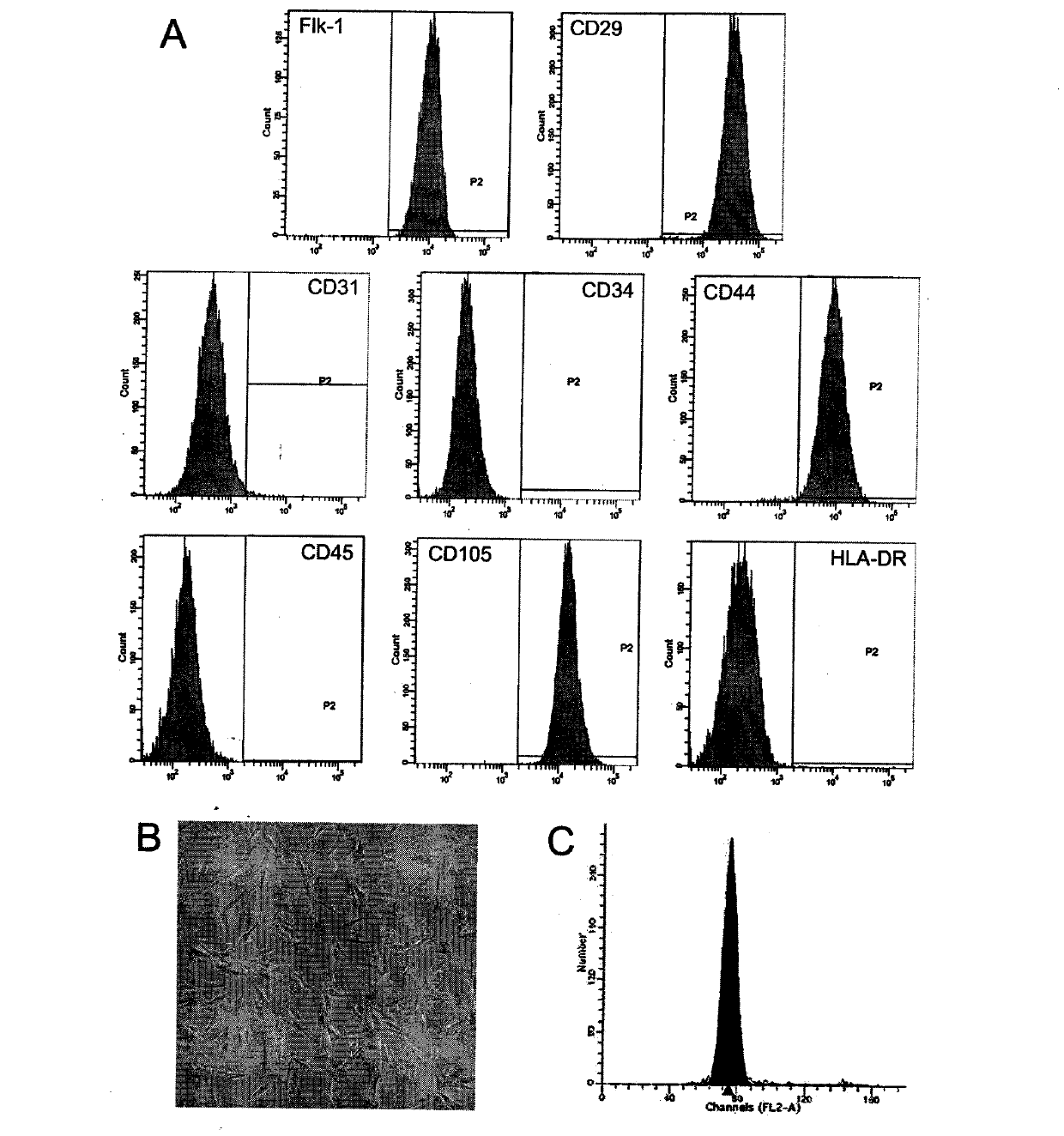 Use of human fat-derived mesenchymal stem cells in treatment of diseases in kidney and ocular fundus