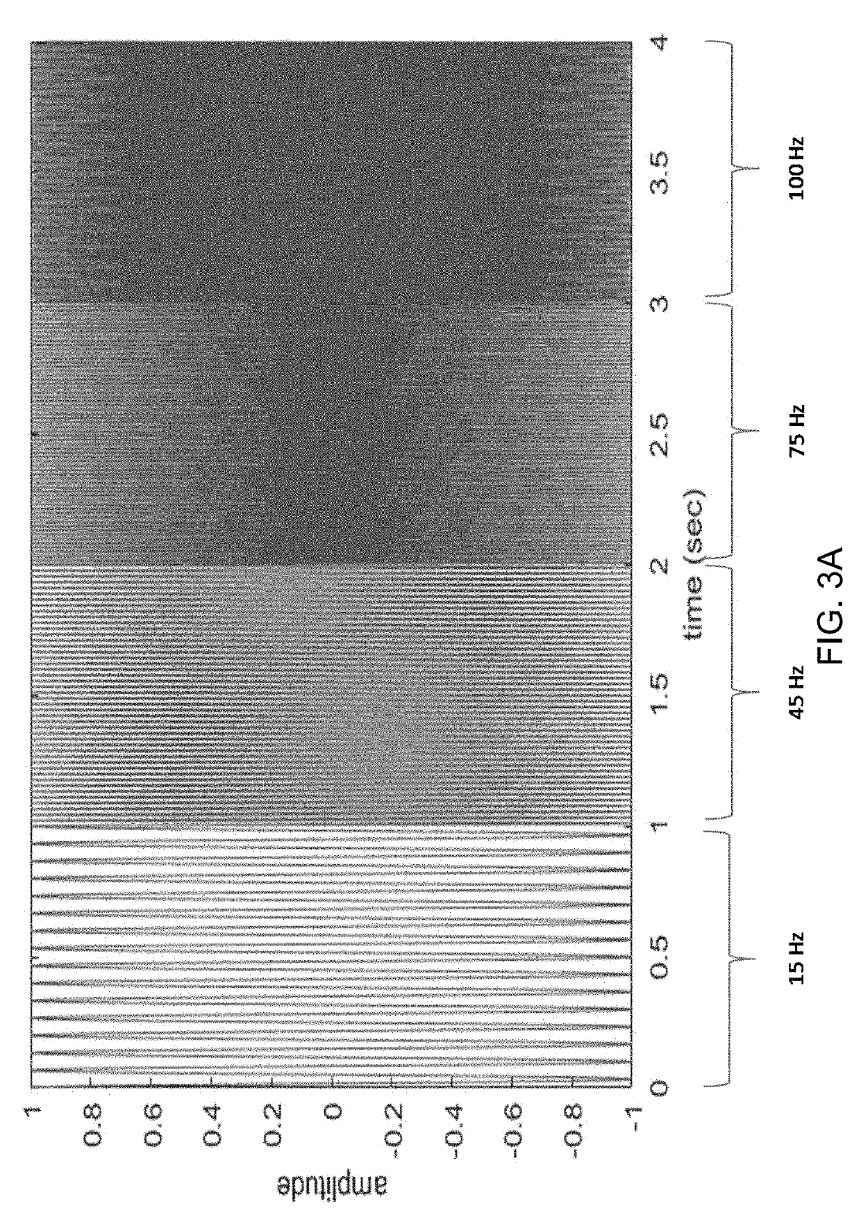 Intelligent parameterization of time-frequency analysis of encephalography signals