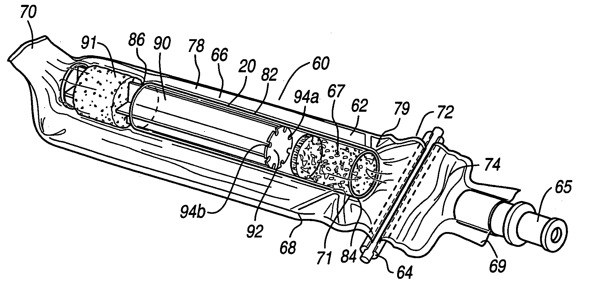 Device and method for hydrating and rehydrating orthopedic graft materials