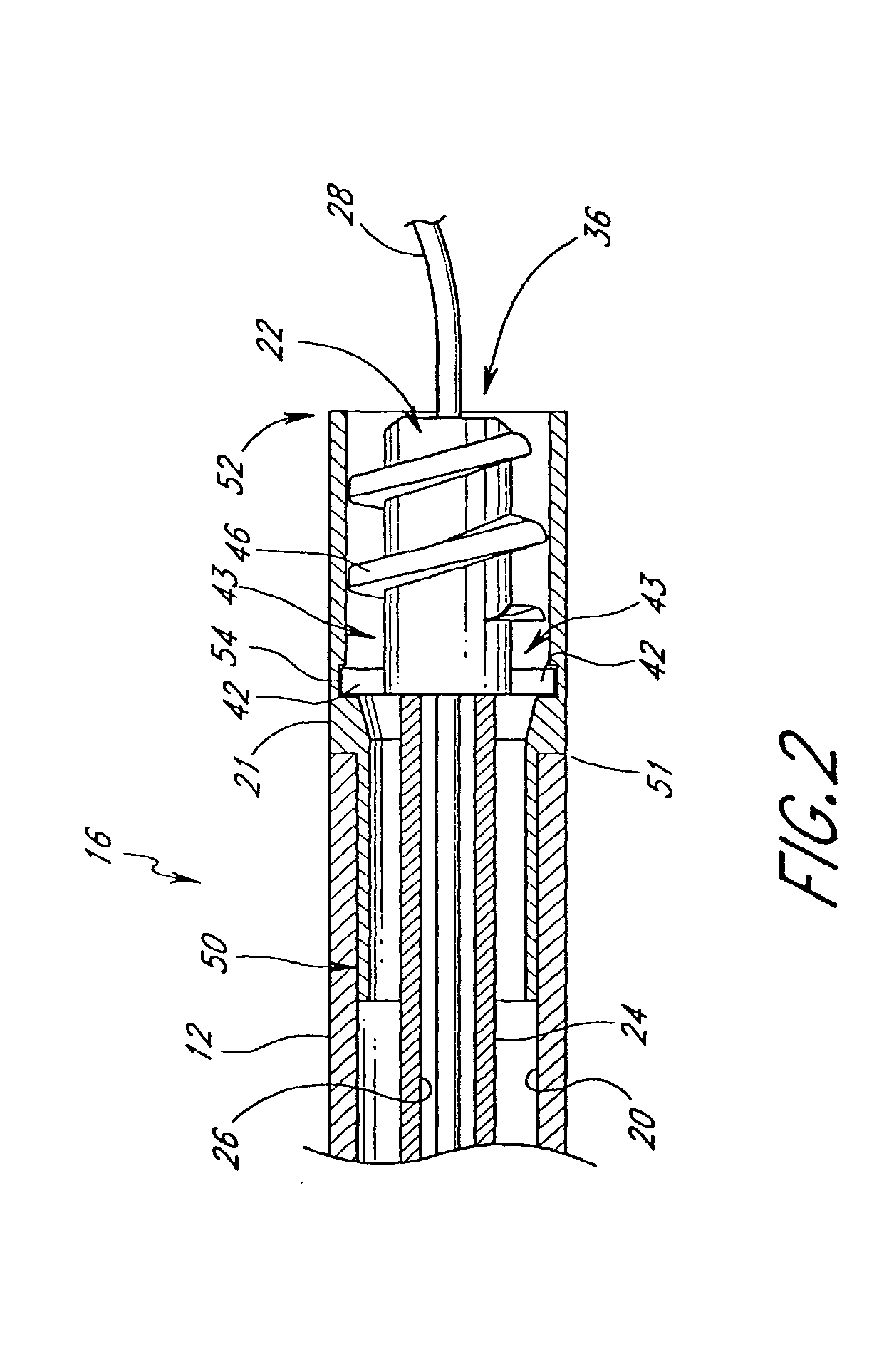 Rotational atherectomy system and methods of use