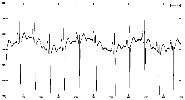 Fall detection method and fall detection system for old man based on three-axis sensor and electrocardiograph sensor