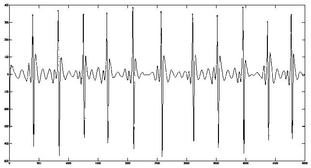 Fall detection method and fall detection system for old man based on three-axis sensor and electrocardiograph sensor