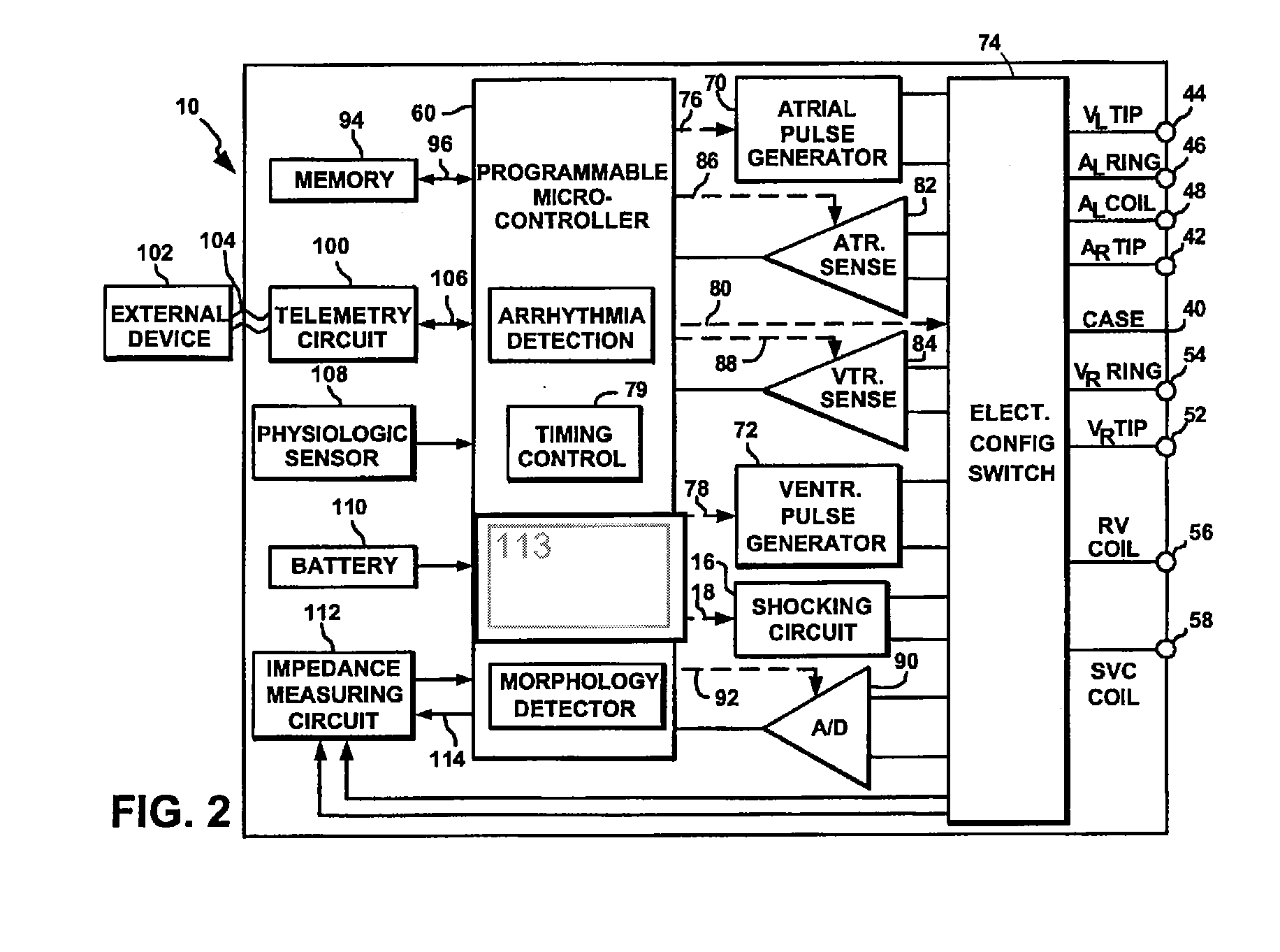 Early detection of lead failure using an impedance histogram