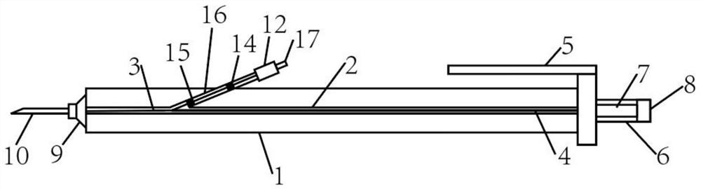 Novel automatic thread embedding pen for acupuncture