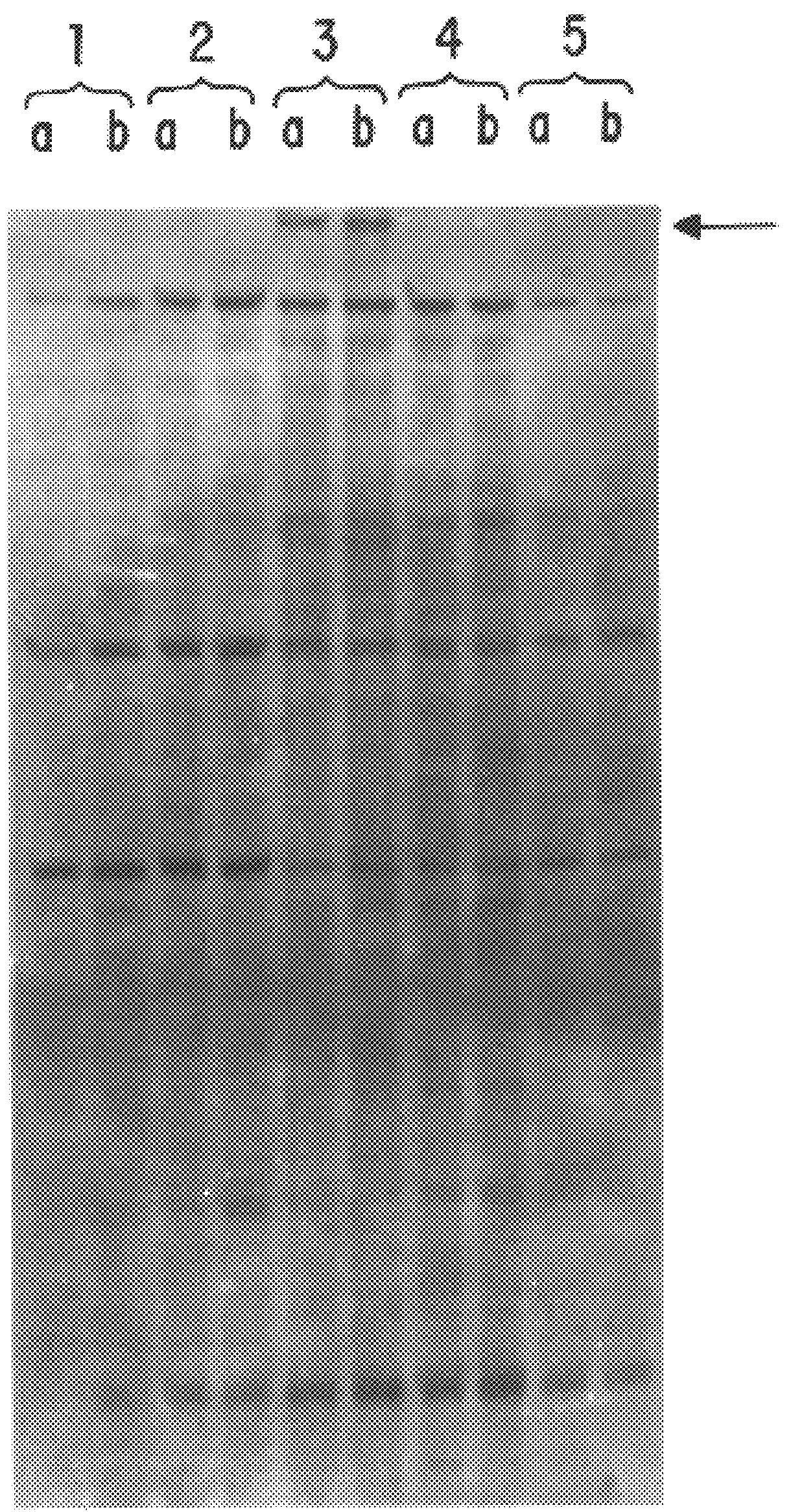 Compositions and methods for the treatment and diagnosis of immune disorders