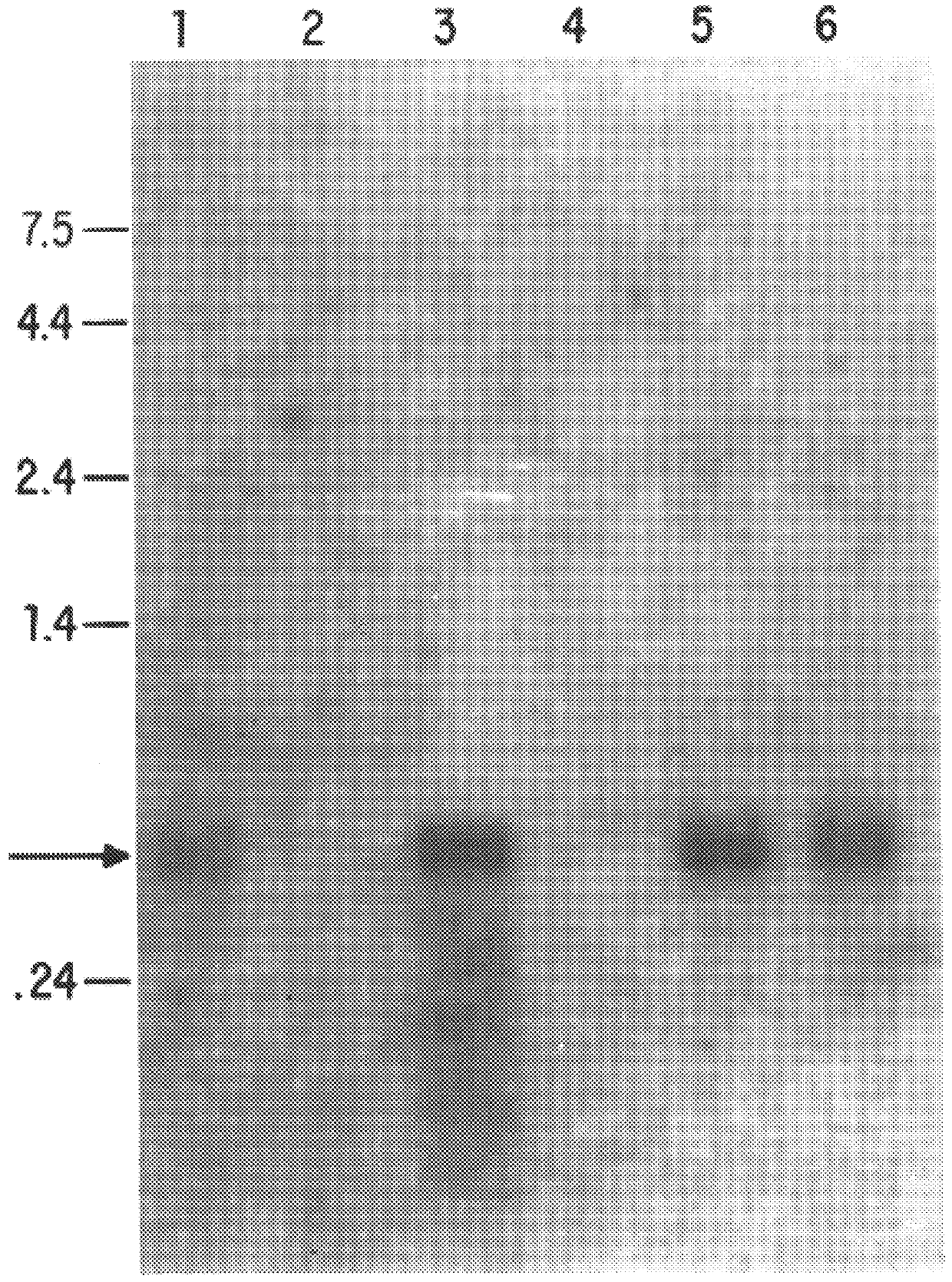 Compositions and methods for the treatment and diagnosis of immune disorders