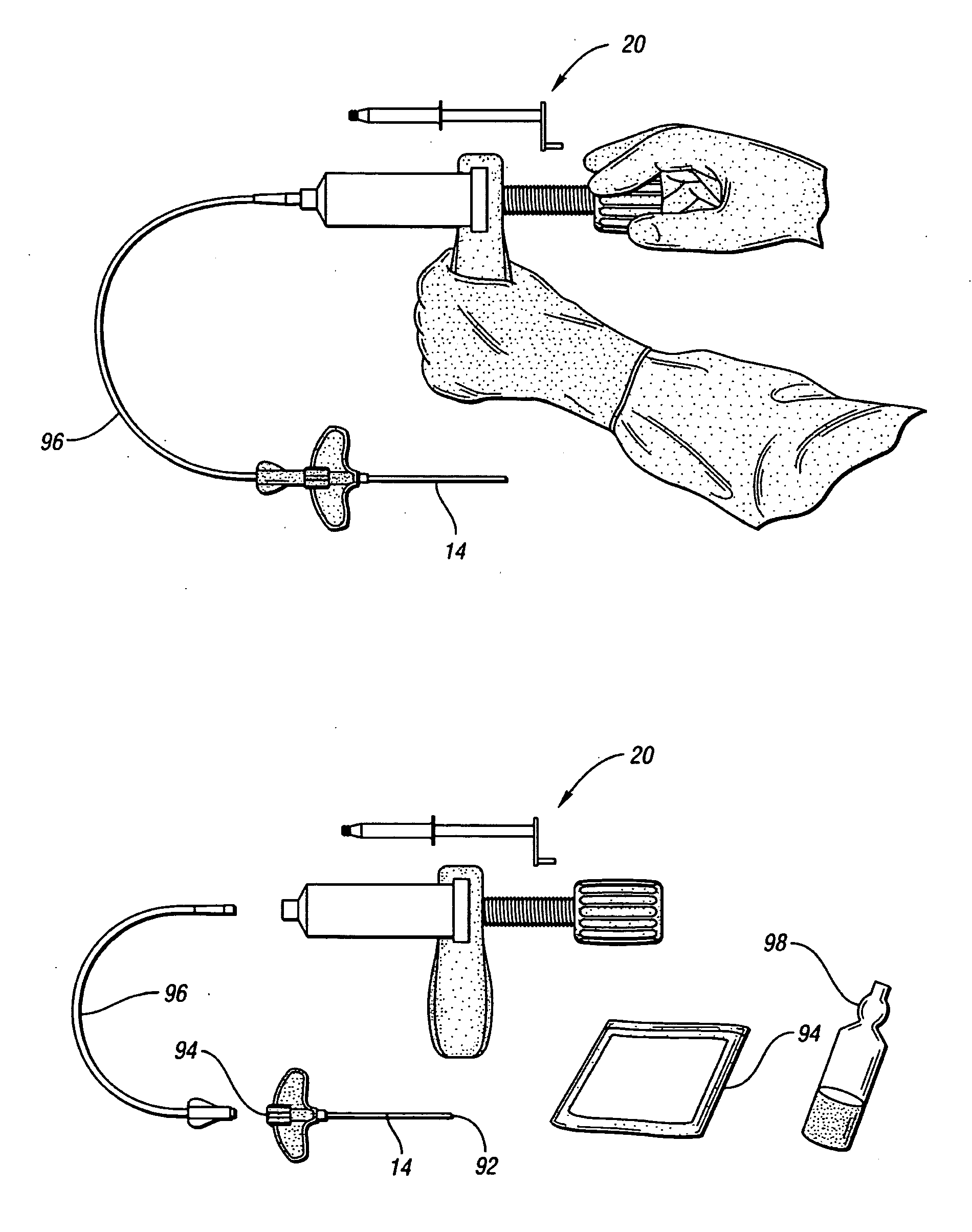 Vertebroplasty all in one mixer