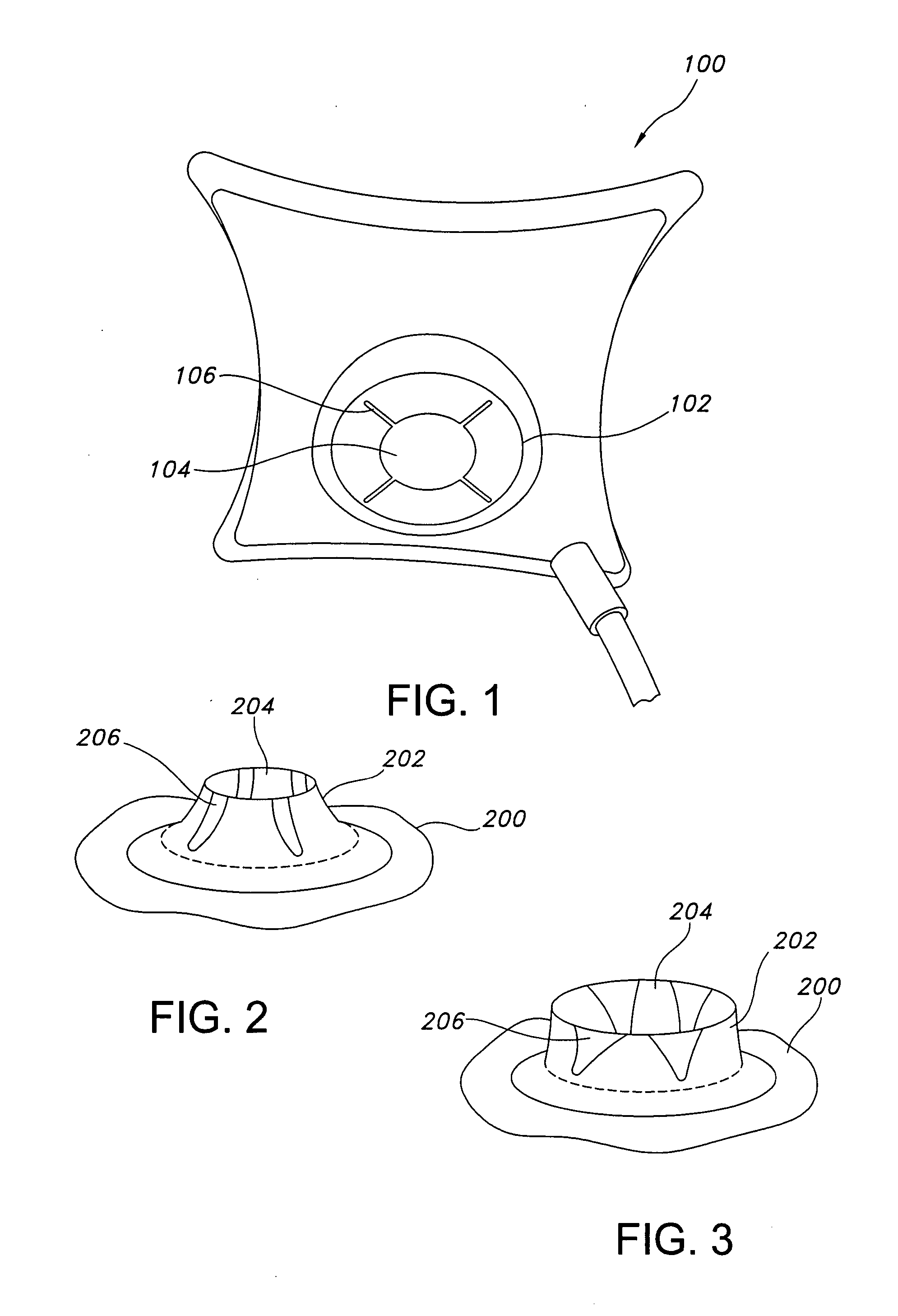 Airbag vent