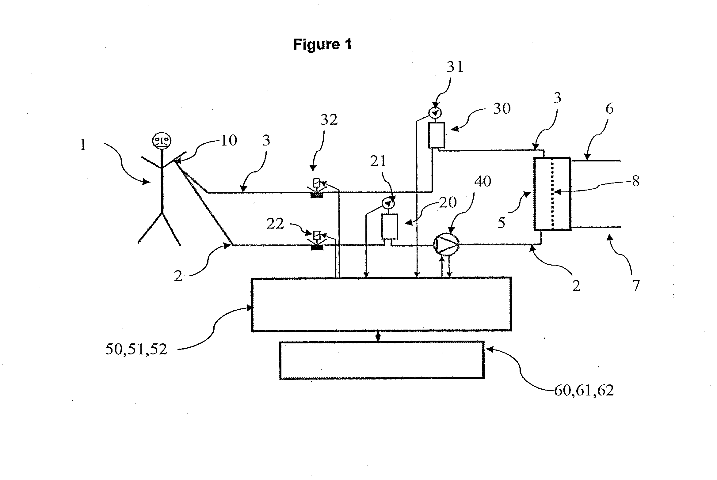 Extracorporeal blood treatment appliance