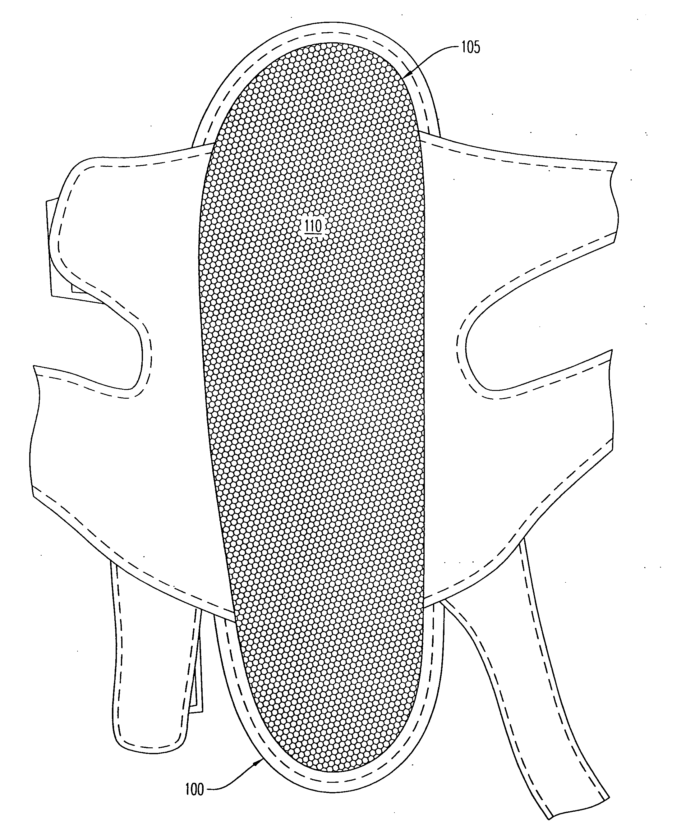 Method to capture and support a 3-D contour