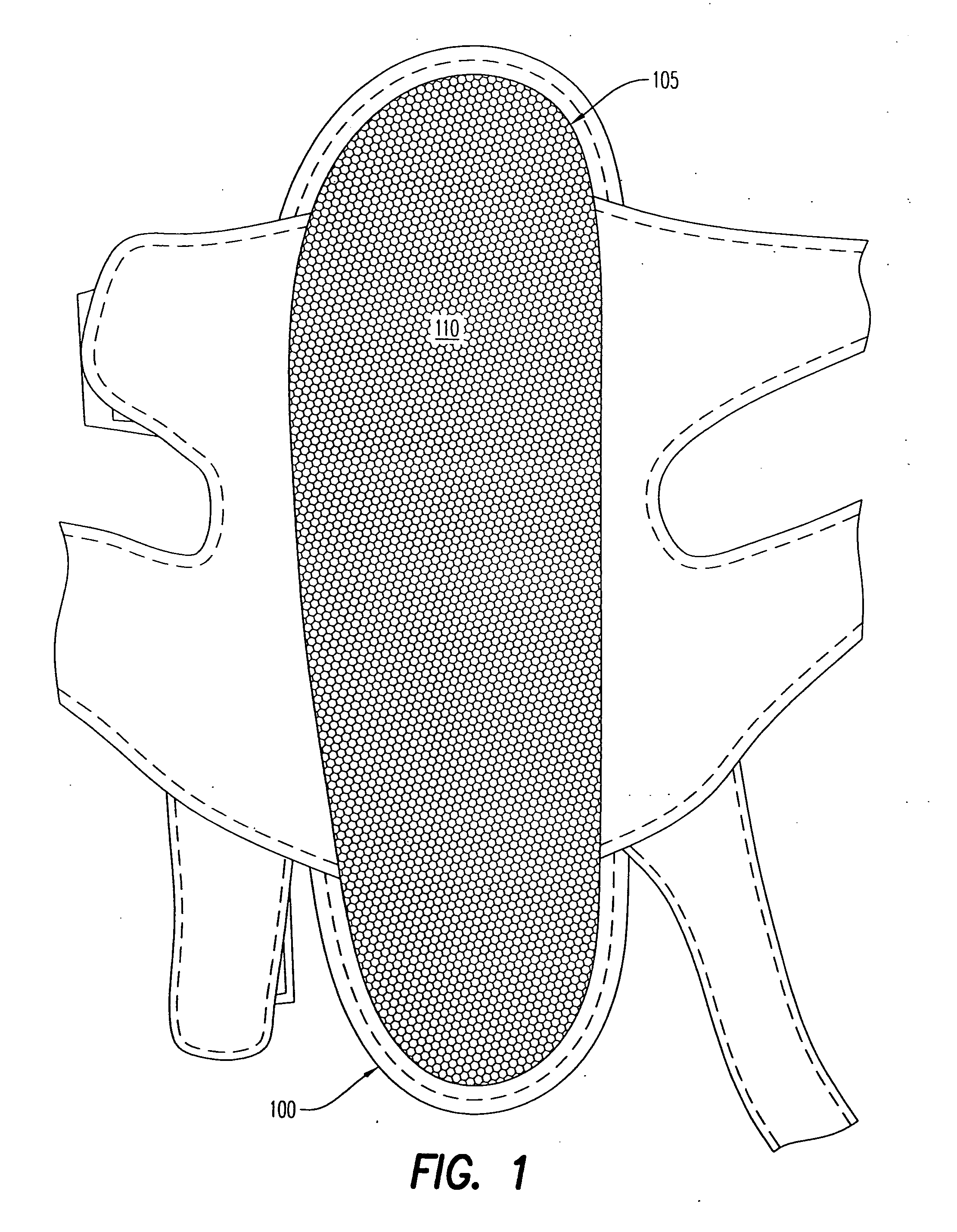 Method to capture and support a 3-D contour