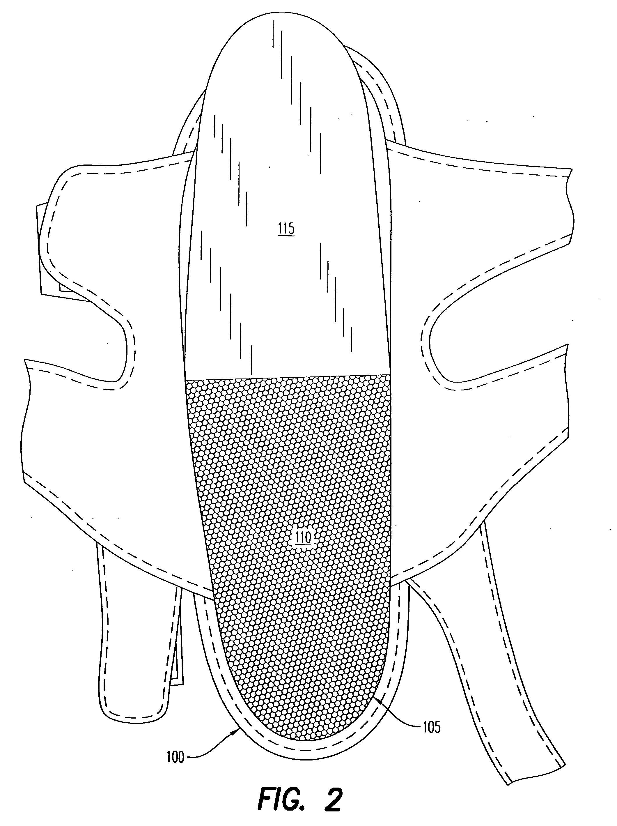 Method to capture and support a 3-D contour