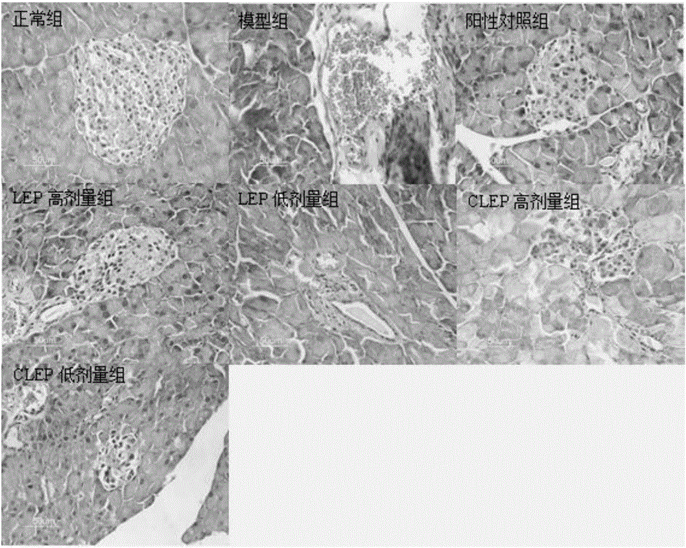 Carboxymethylated lachnum extracellular polysaccharide and application of carboxymethylated lachnum extracellular polysaccharide to hypoglycemic drug