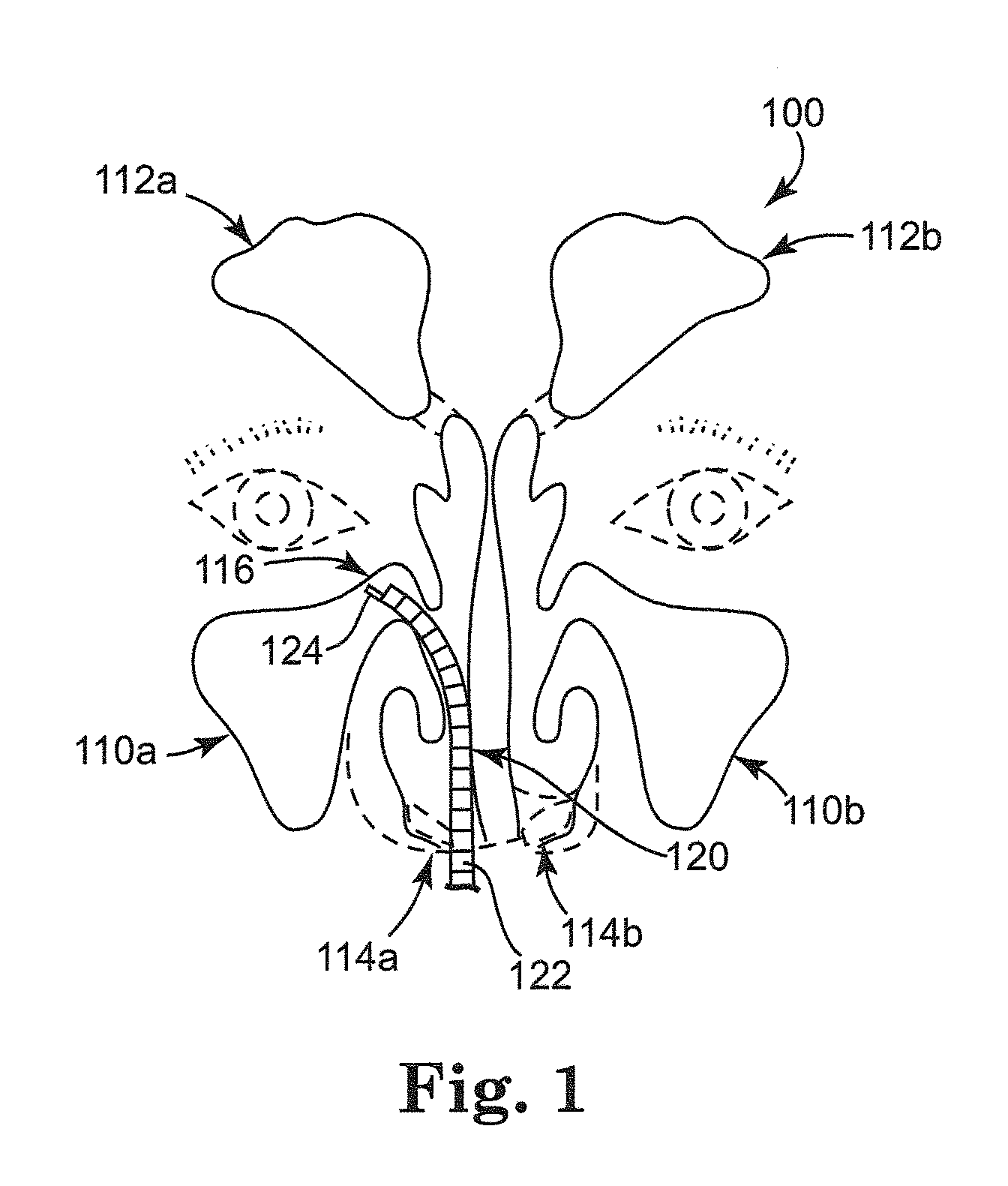 Rehydratable polysaccharide particles and sponge