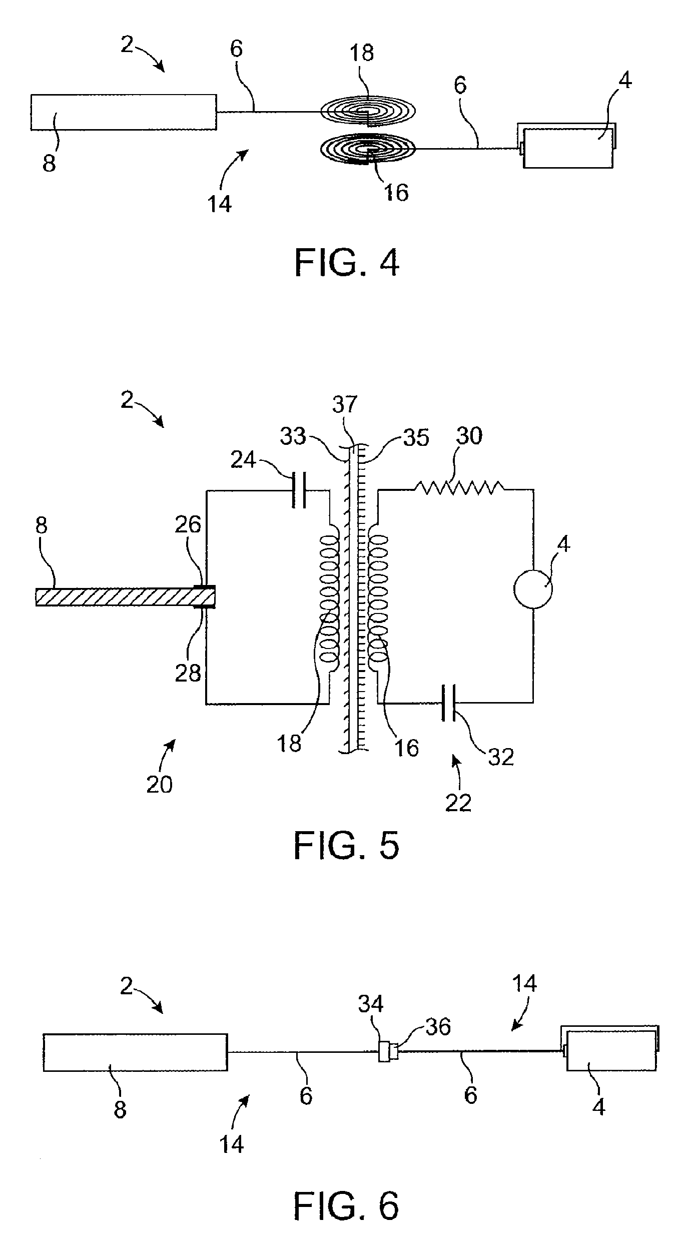 On-off implant for supporting the tongue